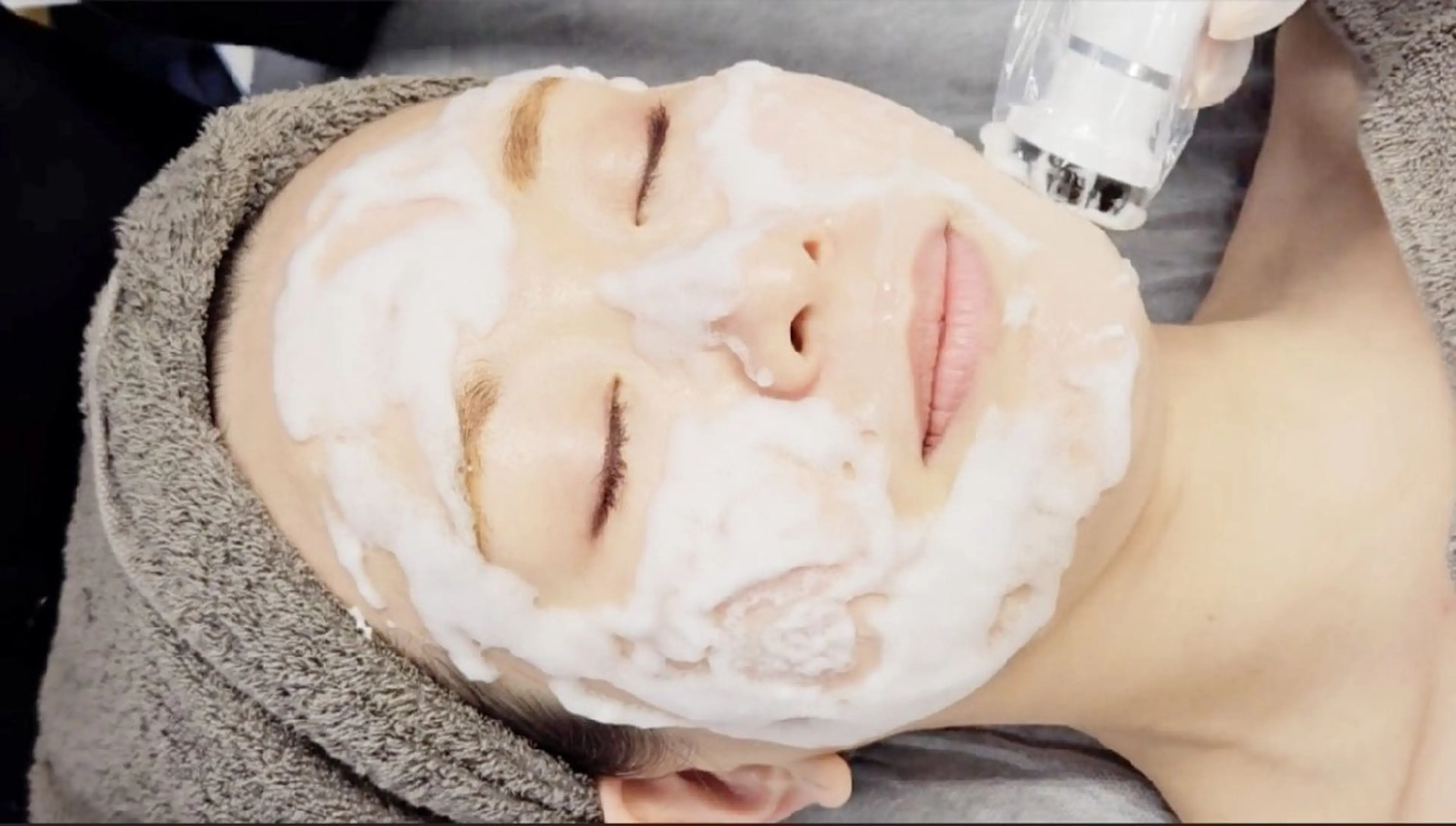 特許施術　プラズマ+炭酸パック　プラズマと同時に炭酸パックを施術。ニキビ、くすみ、、乾燥肌。一度で驚くほど明るいお肌へ。の写真