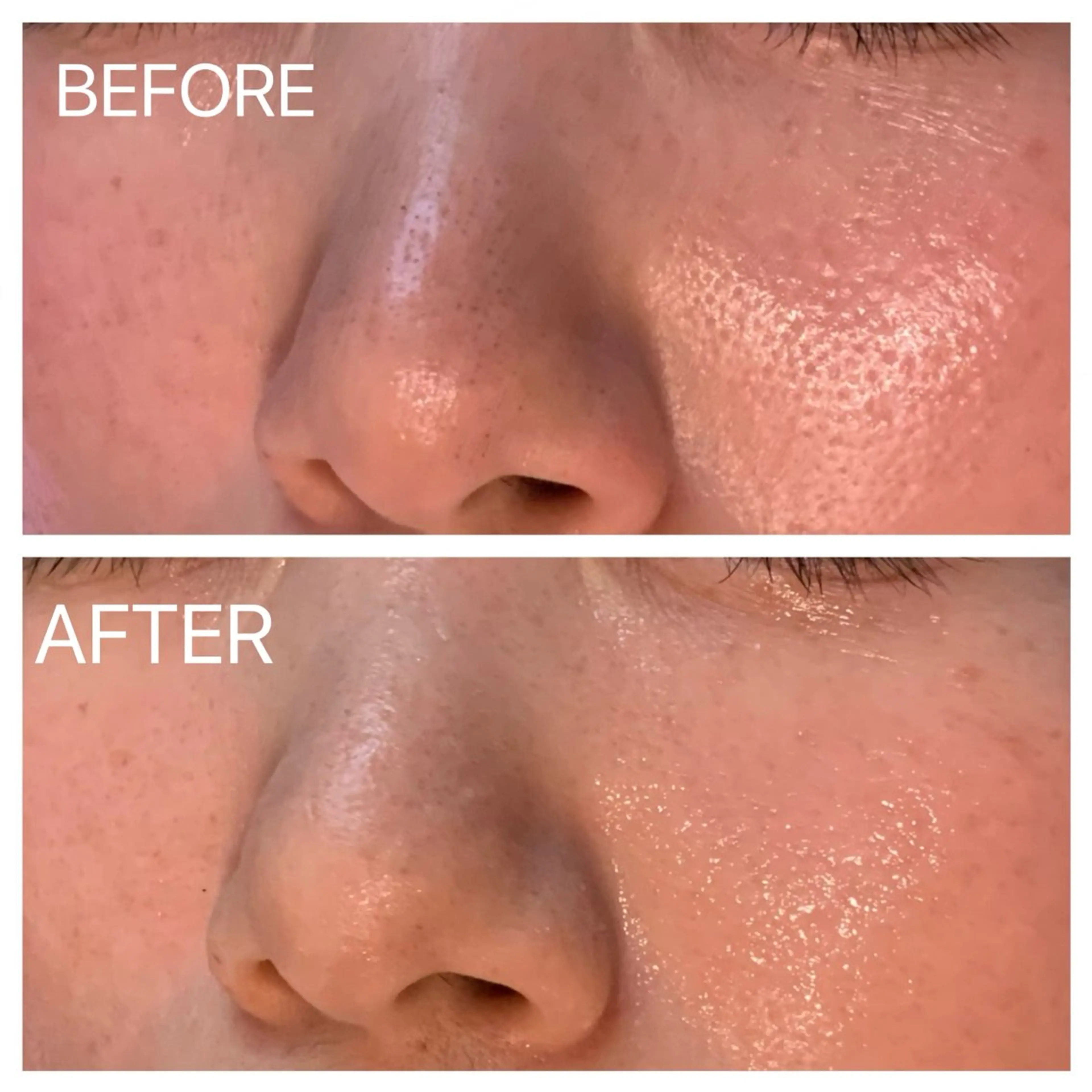 エステサロンSheep(美容室Sheep)所属・肌質改善専門 サロンのエステ・リラクイメージ