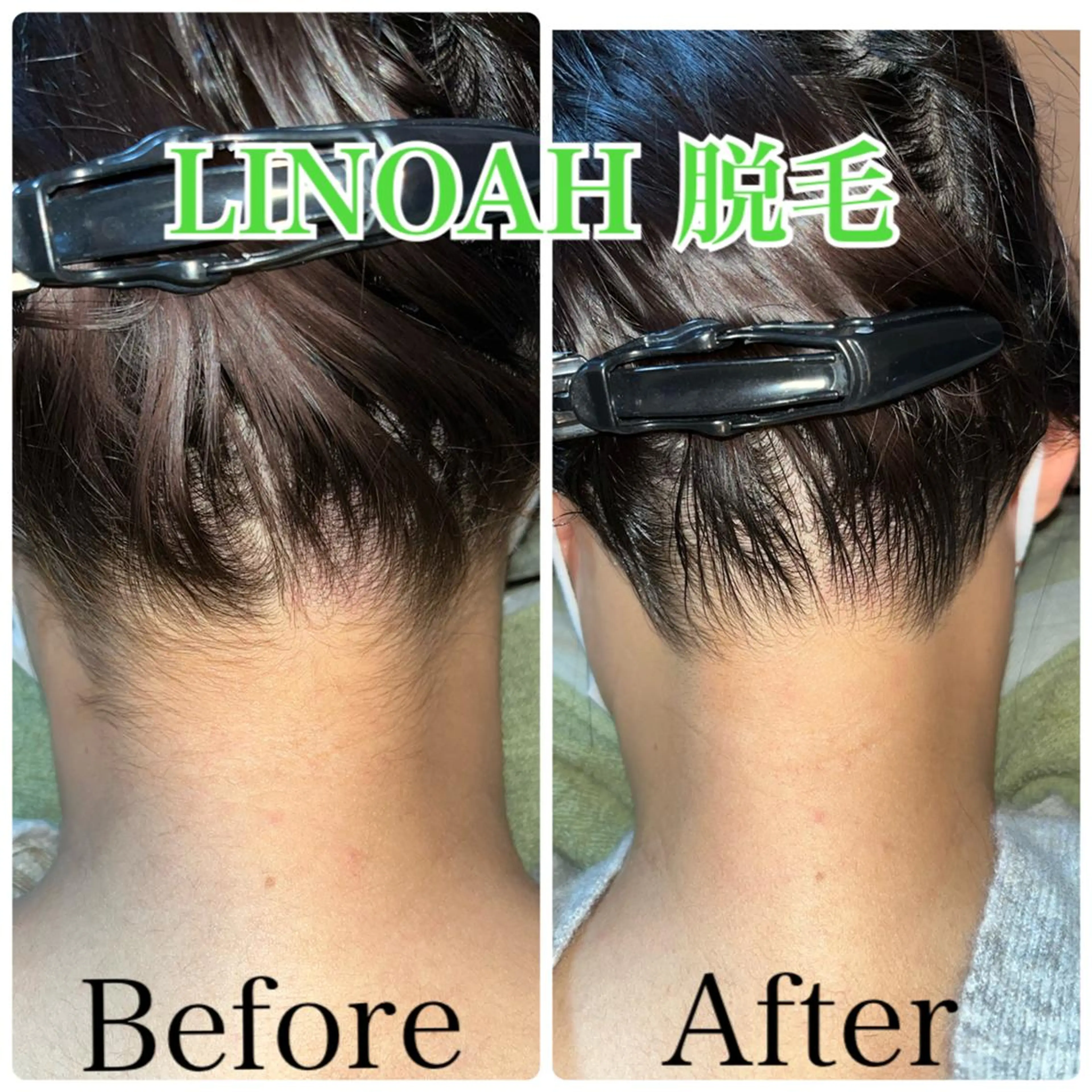 ビューティーサロン リノアのエステ・リラクイメージ