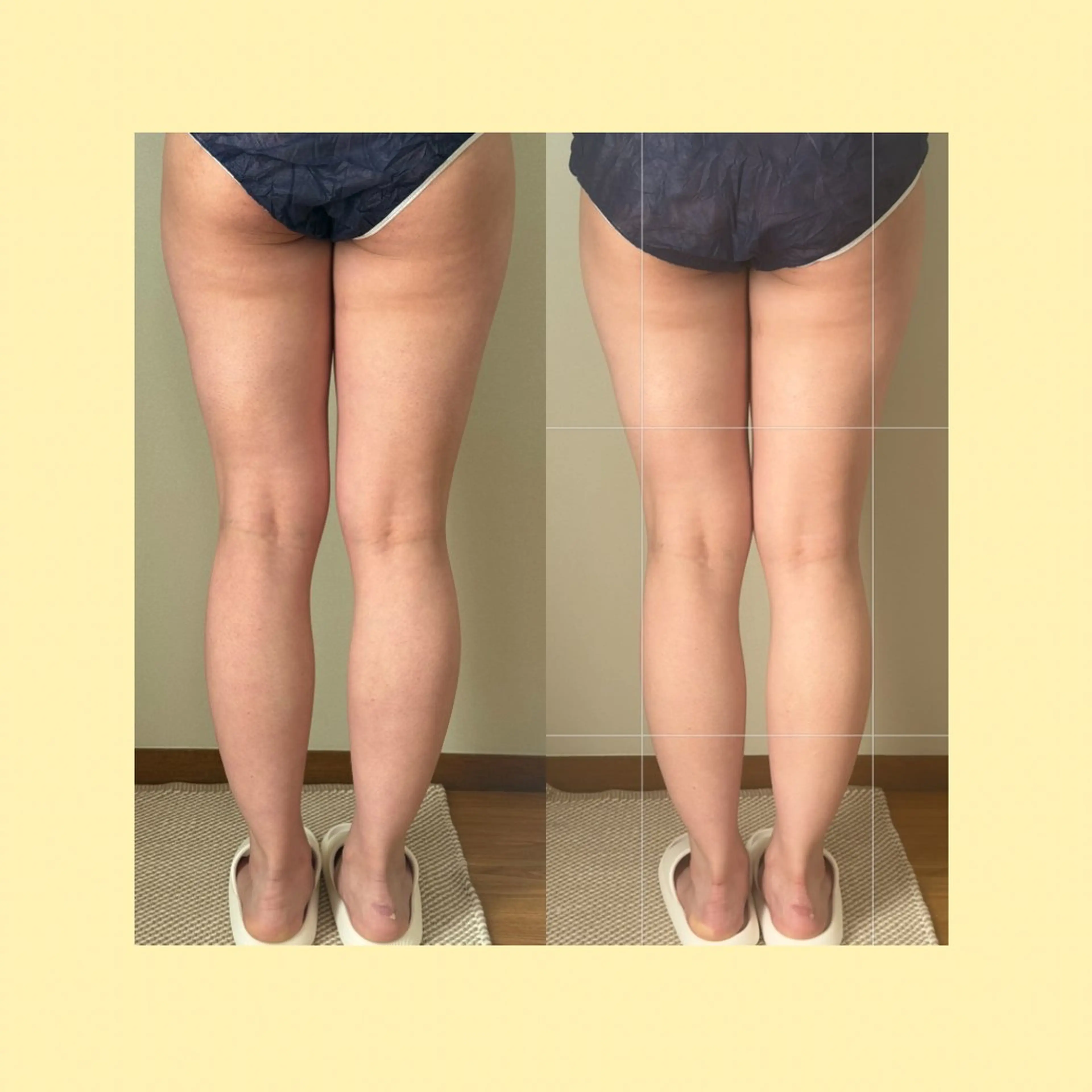 リラクゼーションスパ　ひのき所属・spaHINOKI 【女性専用】のエステ・リラクイメージ