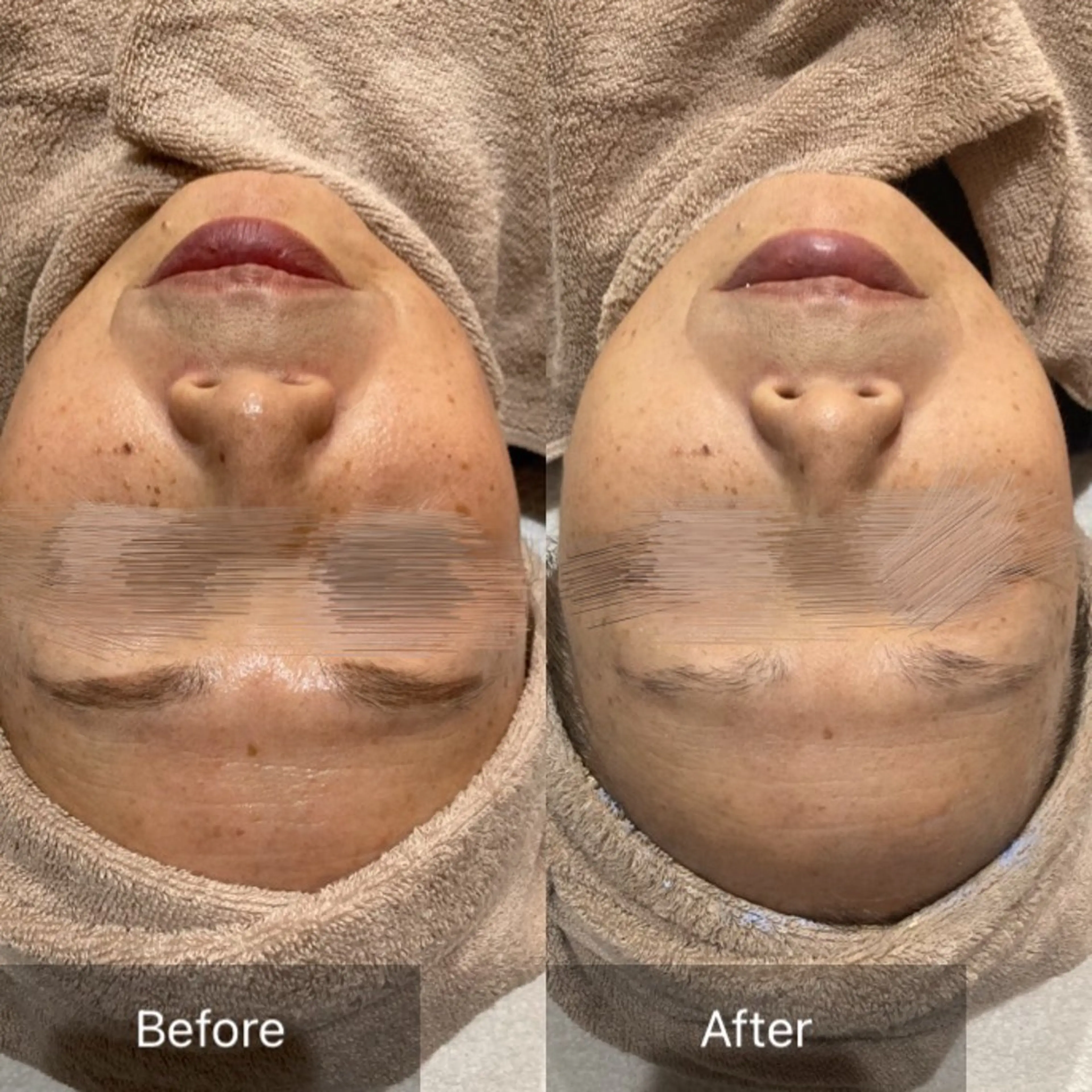 【剥離なしピーリング✨】クリスティーナ イラストリアス【最強美白】の写真