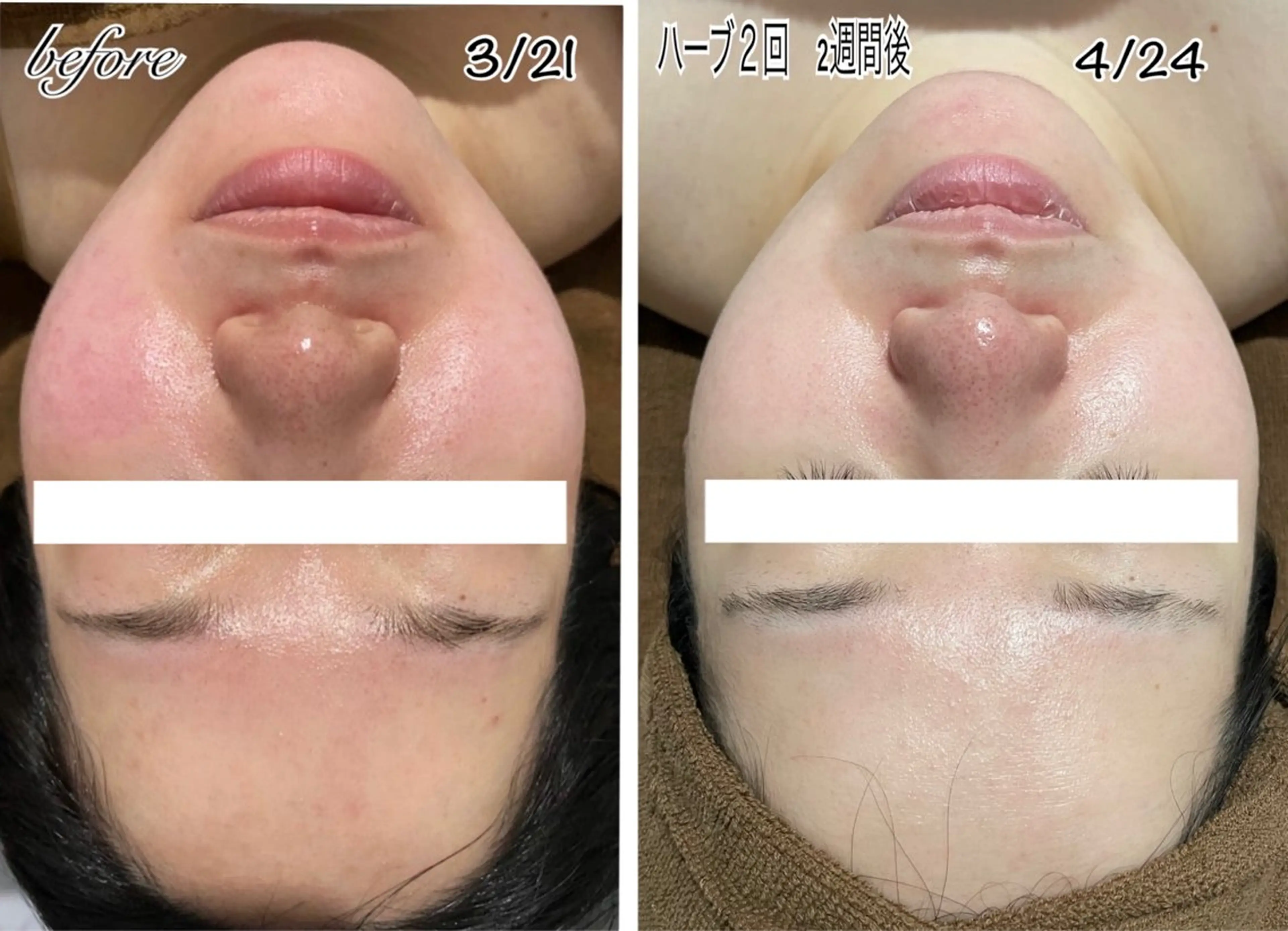 その他 ENCHANT 脱毛.小顔.毛穴のエステ・リラクイメージ