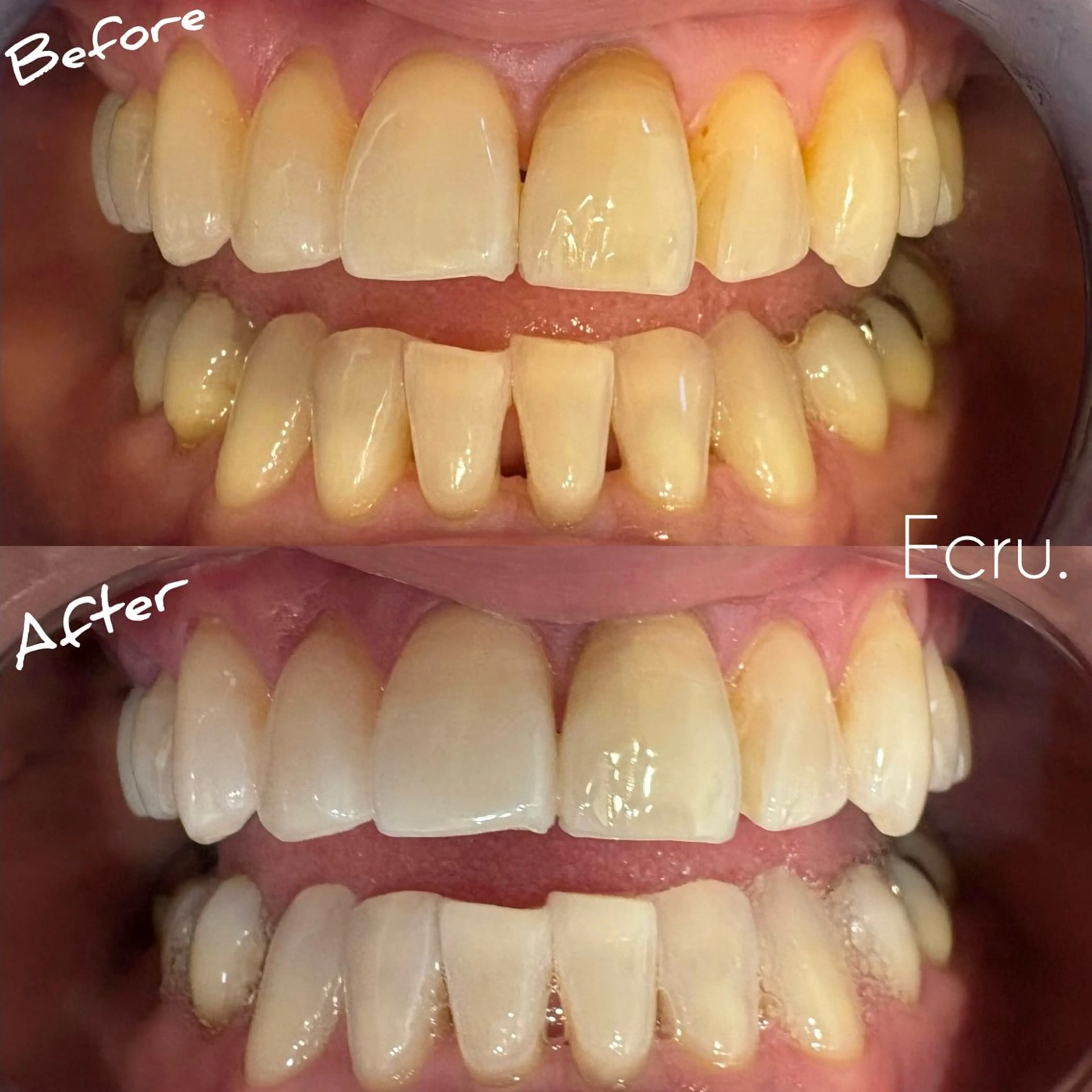 メンズ キッズ ホワイトニングサロン Ecru所属・ホワイトニングサロン Ecru エクリュのその他イメージ