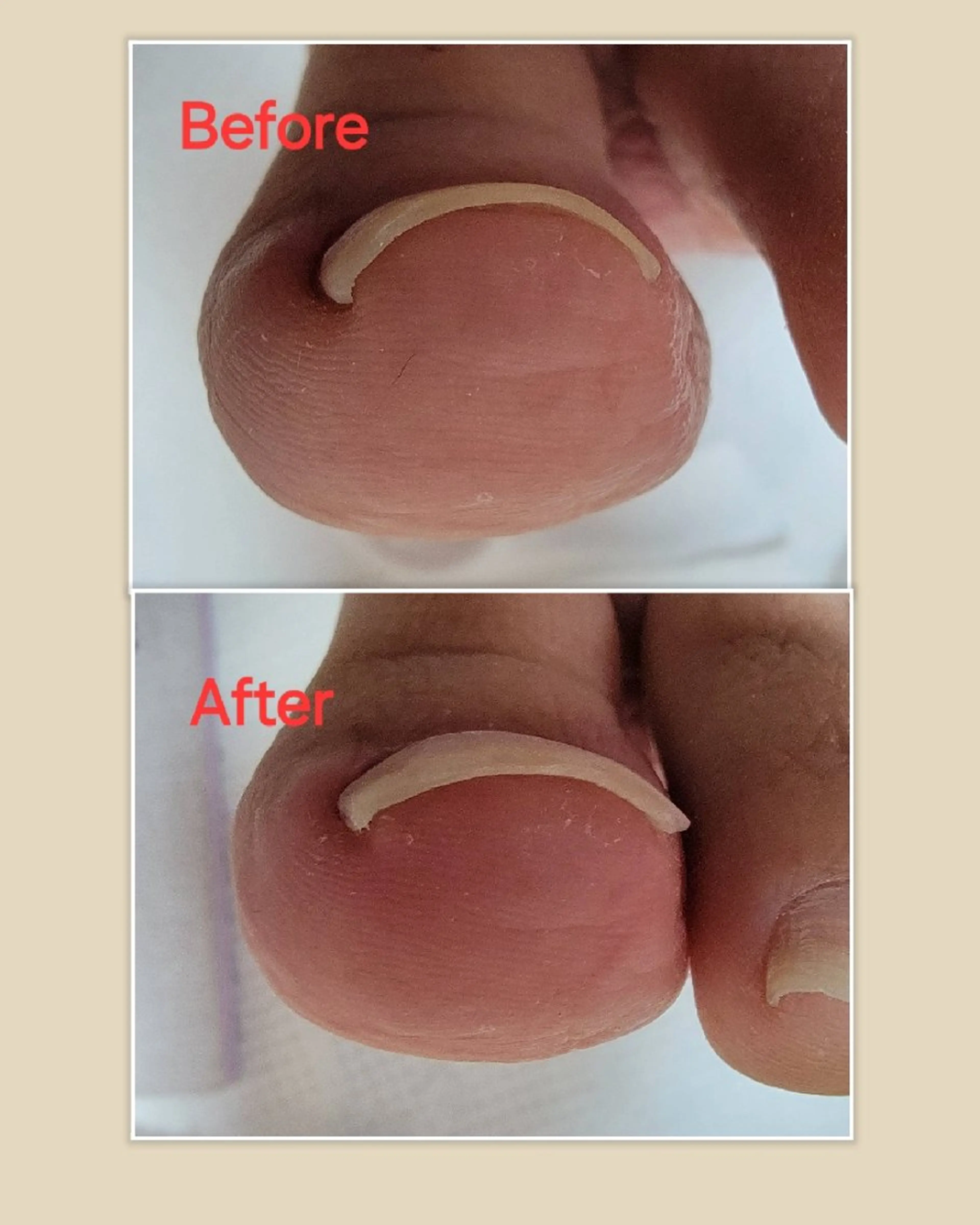 ネイル&巻き爪サロン 　AKnailのネイルデザイン