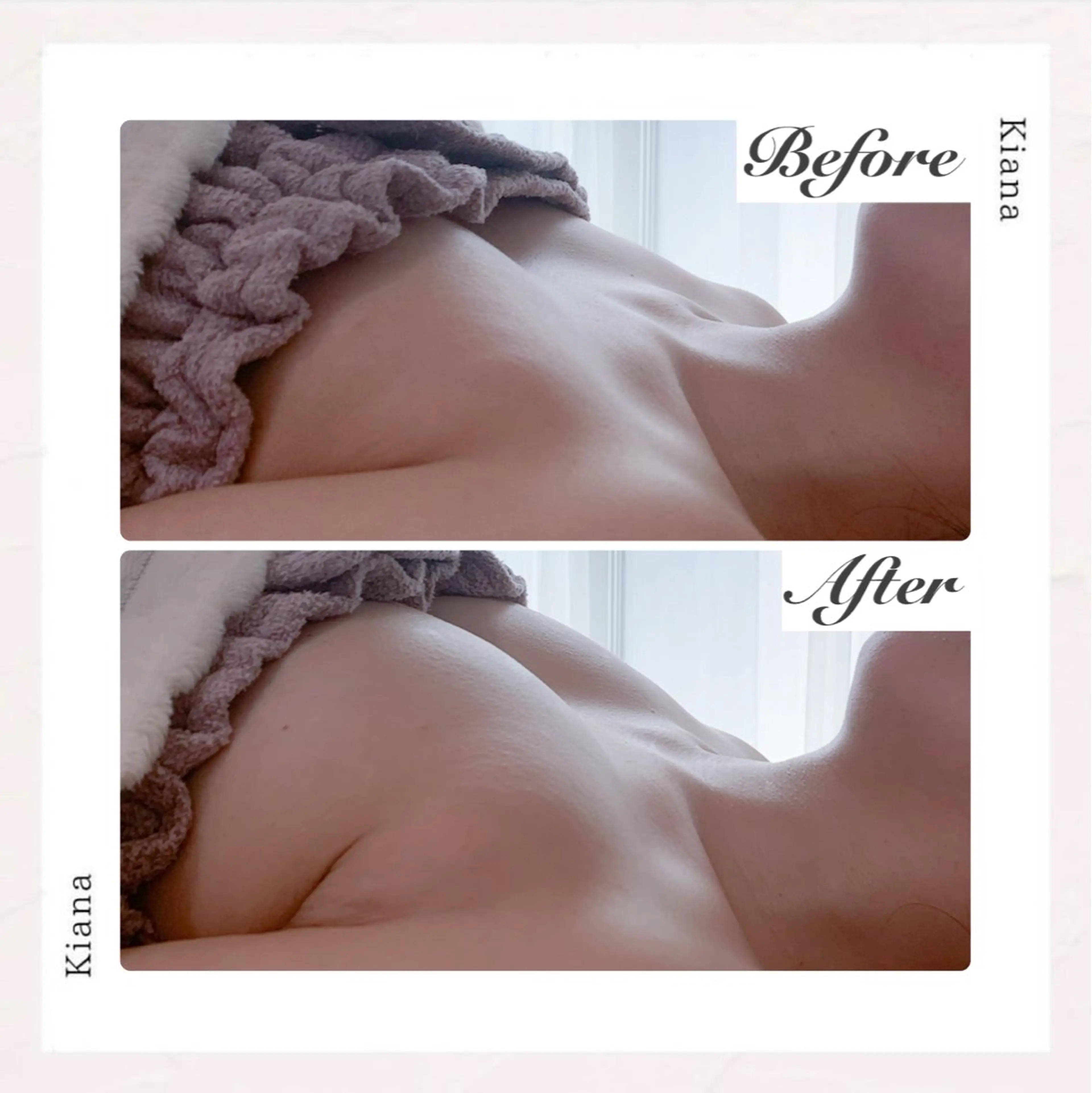 エステ リラク バスト専門Kiana 風のエステ・リラクイメージ