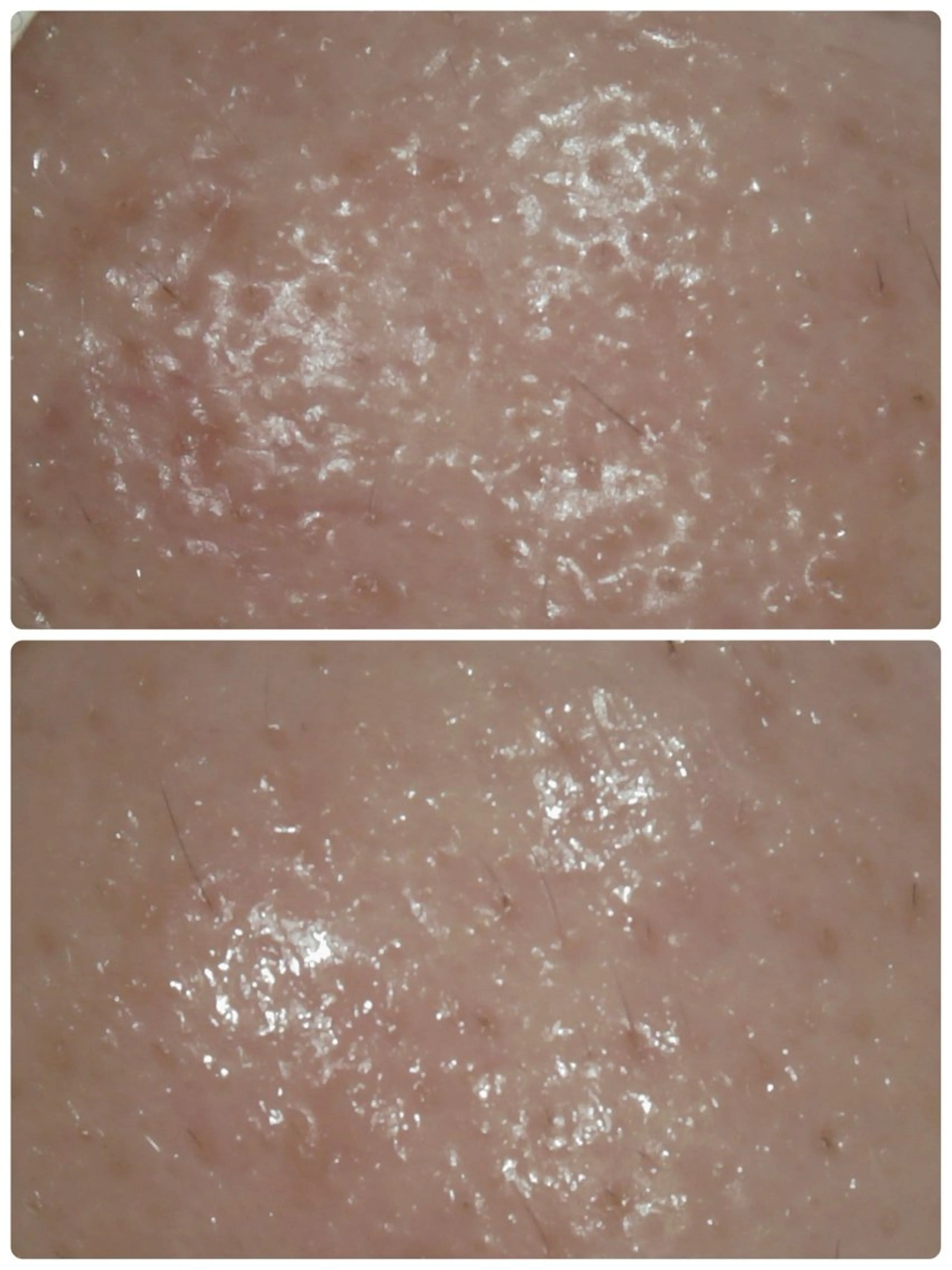 エステ リラク メナード片町 やまもと みくのエステ・リラクイメージ