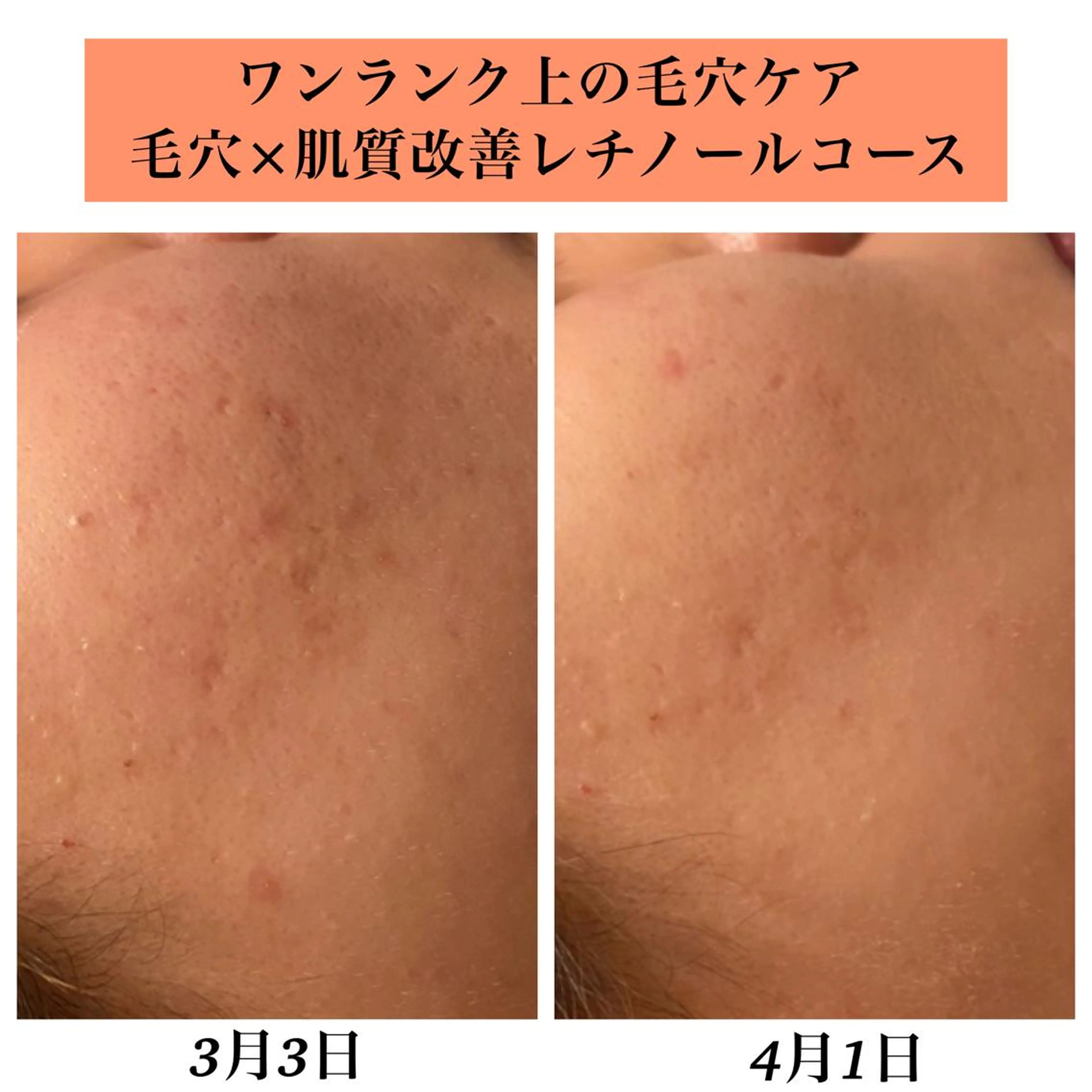 エステ リラク Bellesthe （ベルエステ）のエステ・リラクイメージ