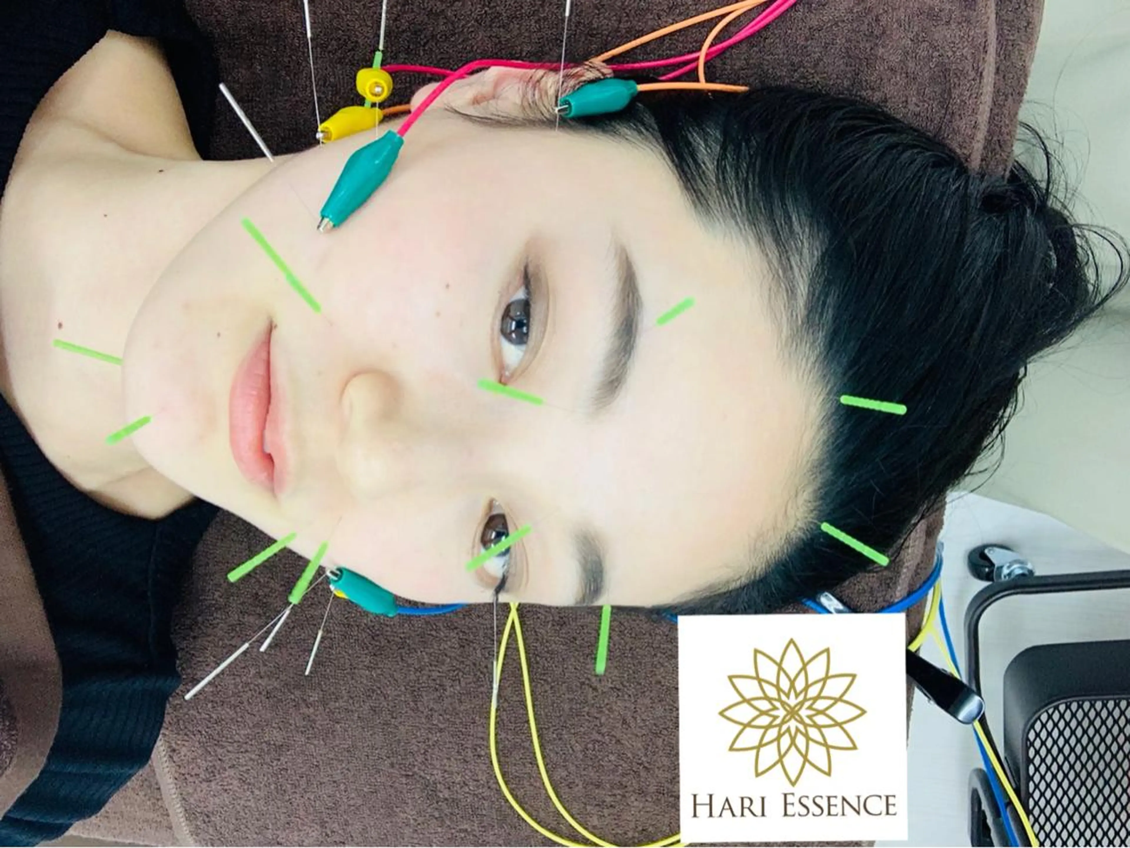 美容鍼灸専門院　ハリエッセンス所属・美容鍼専門鍼灸院 ハリエッセンスのその他イメージ