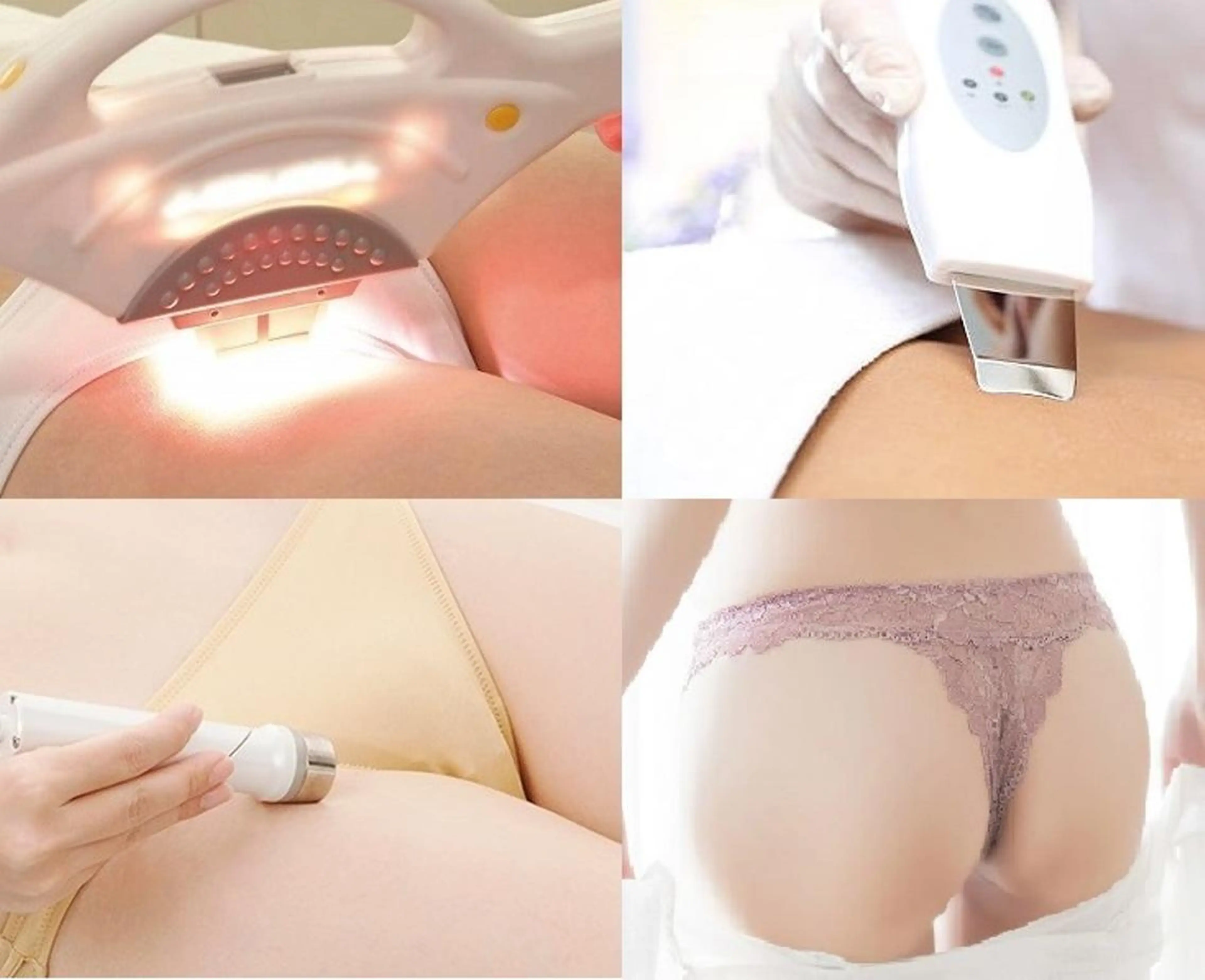 エステ唯一Wケア【美療VIO脱毛】＋【ダメージケア：3種の美容特許トーニング】の写真