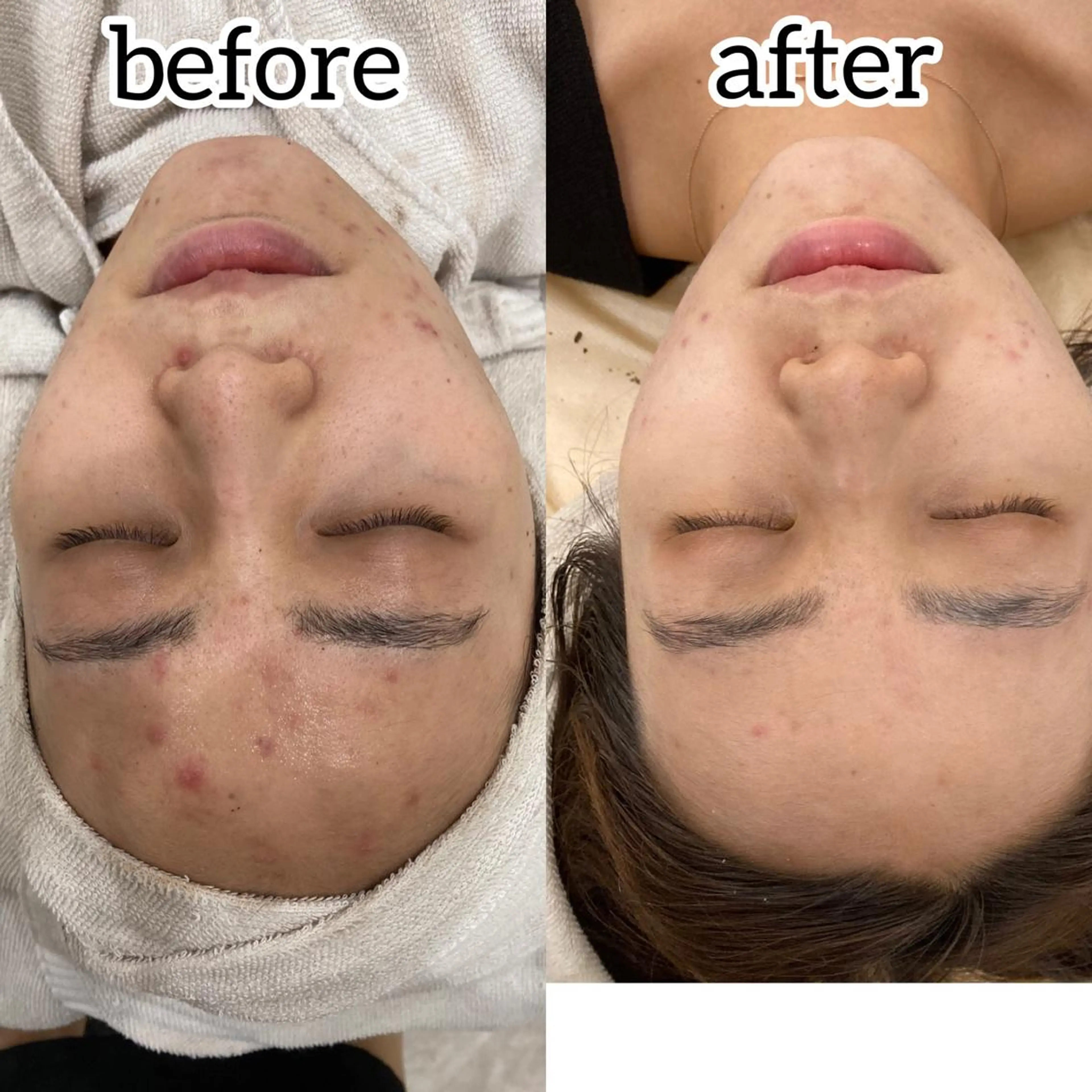 laluna saki...のその他イメージ