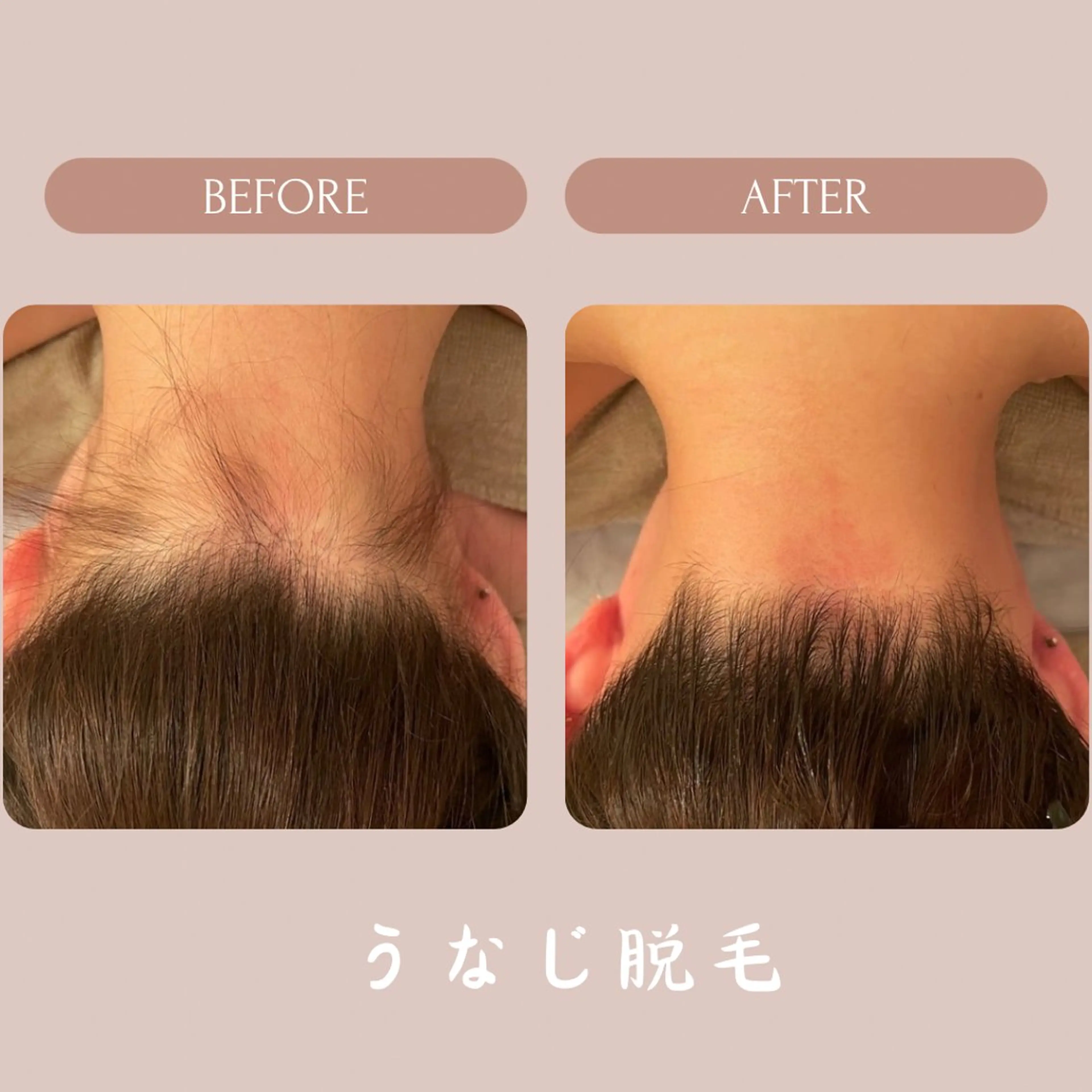 LONO  by a little所属・LONO byalittleのエステ・リラクイメージ