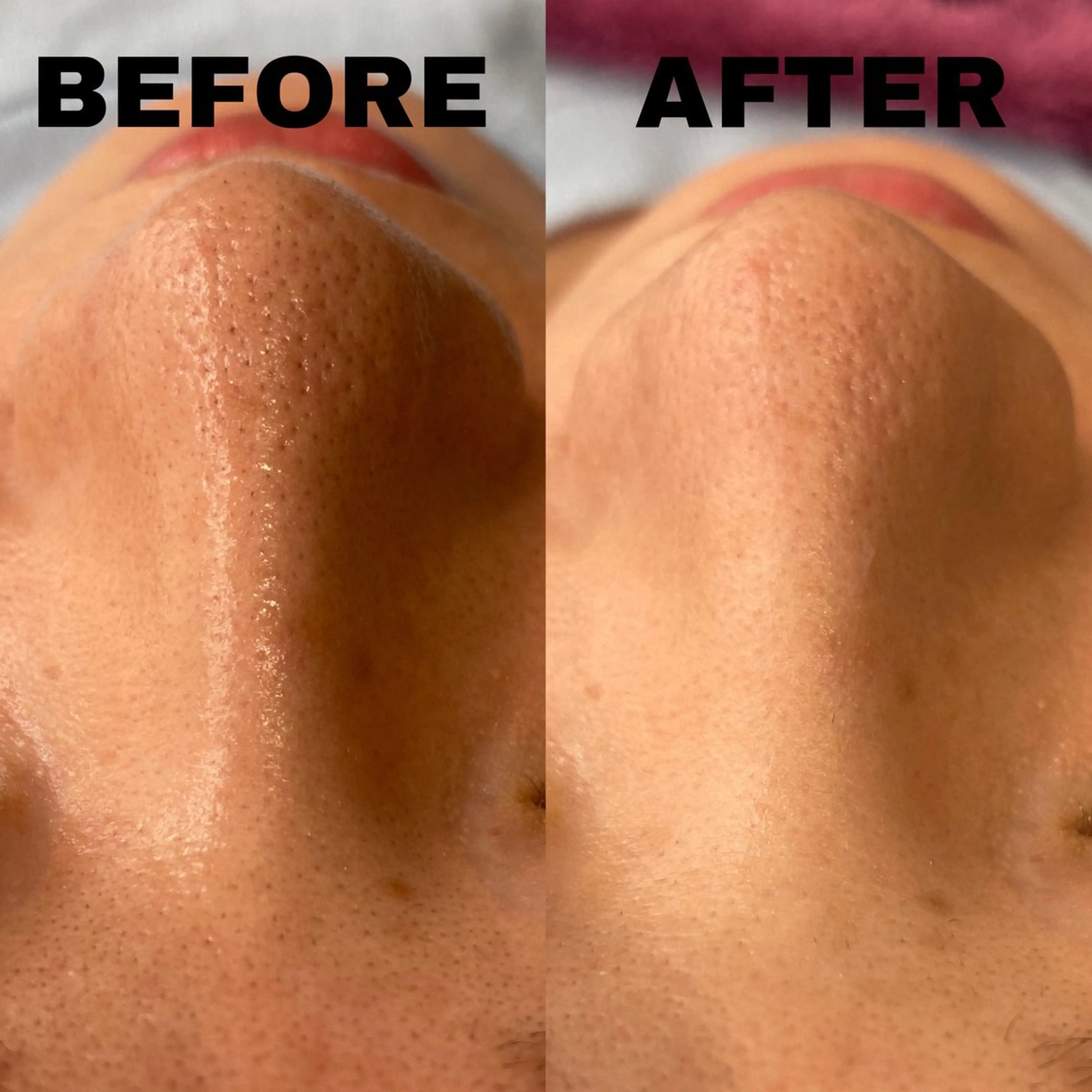 エステ NANI OAFU所属・NANIOAFU [なんば店］のその他イメージ