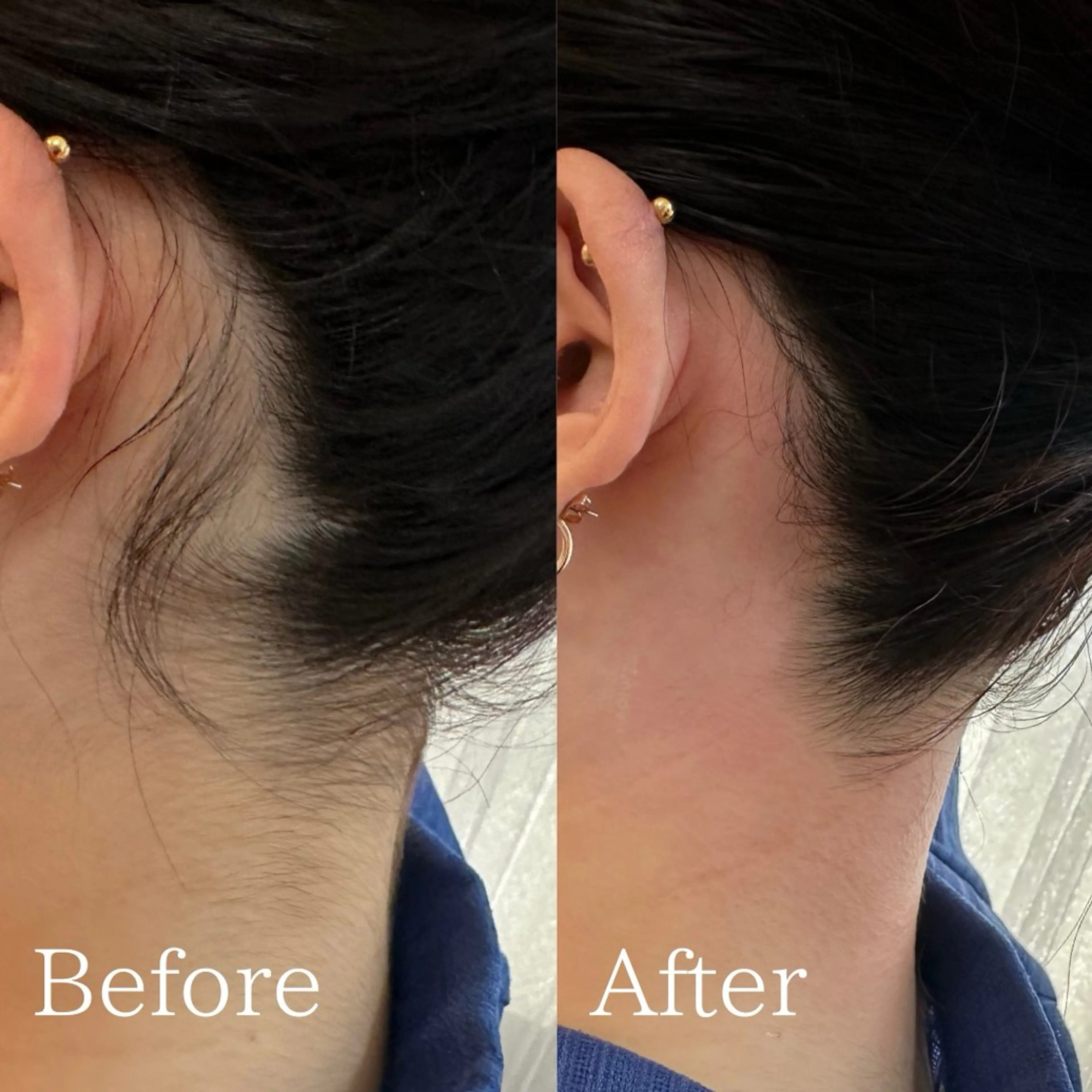 プライベート脱毛サロン　Arum所属・脱毛サロン Arumのエステ・リラクイメージ