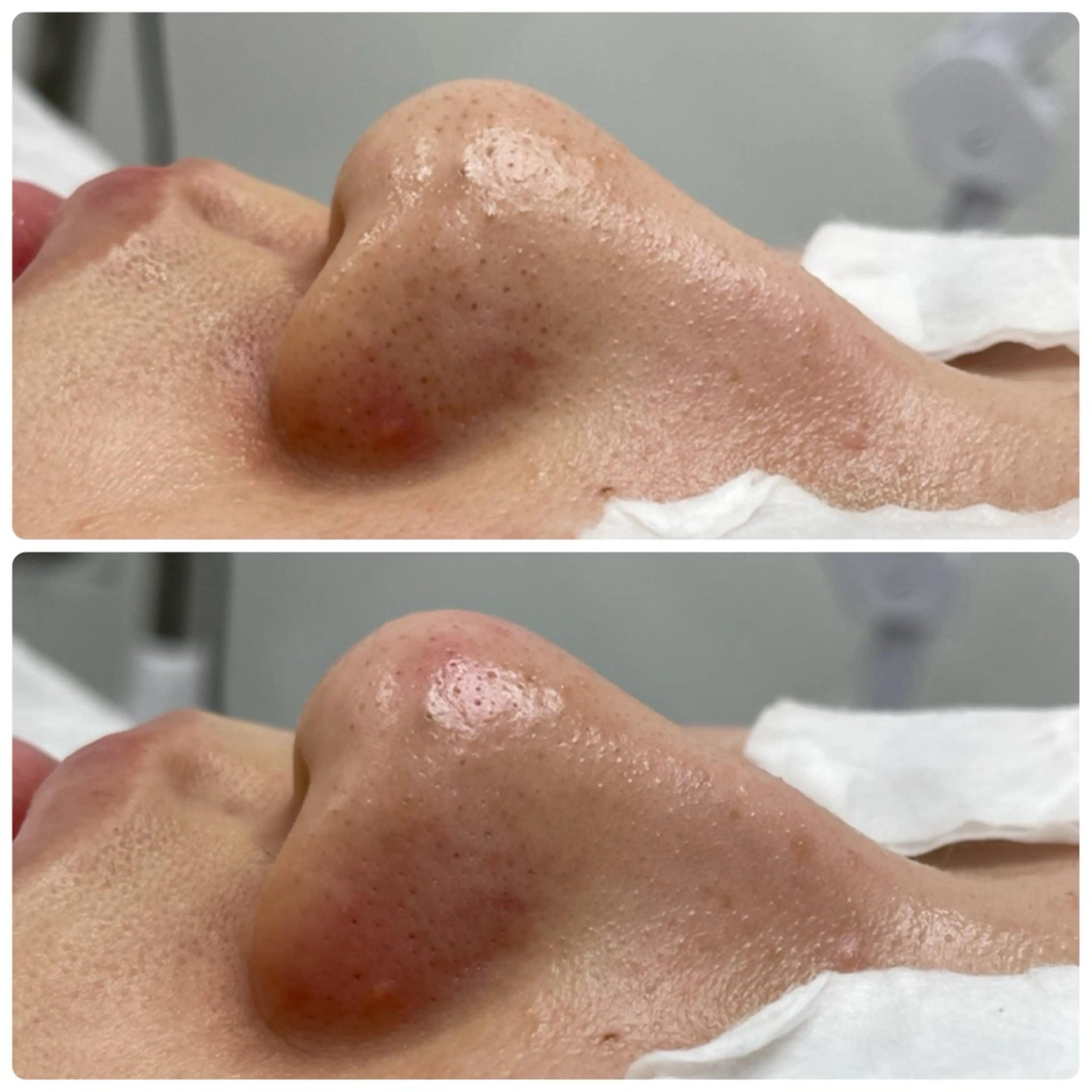 エステ bambina KAIRIのエステ・リラクイメージ