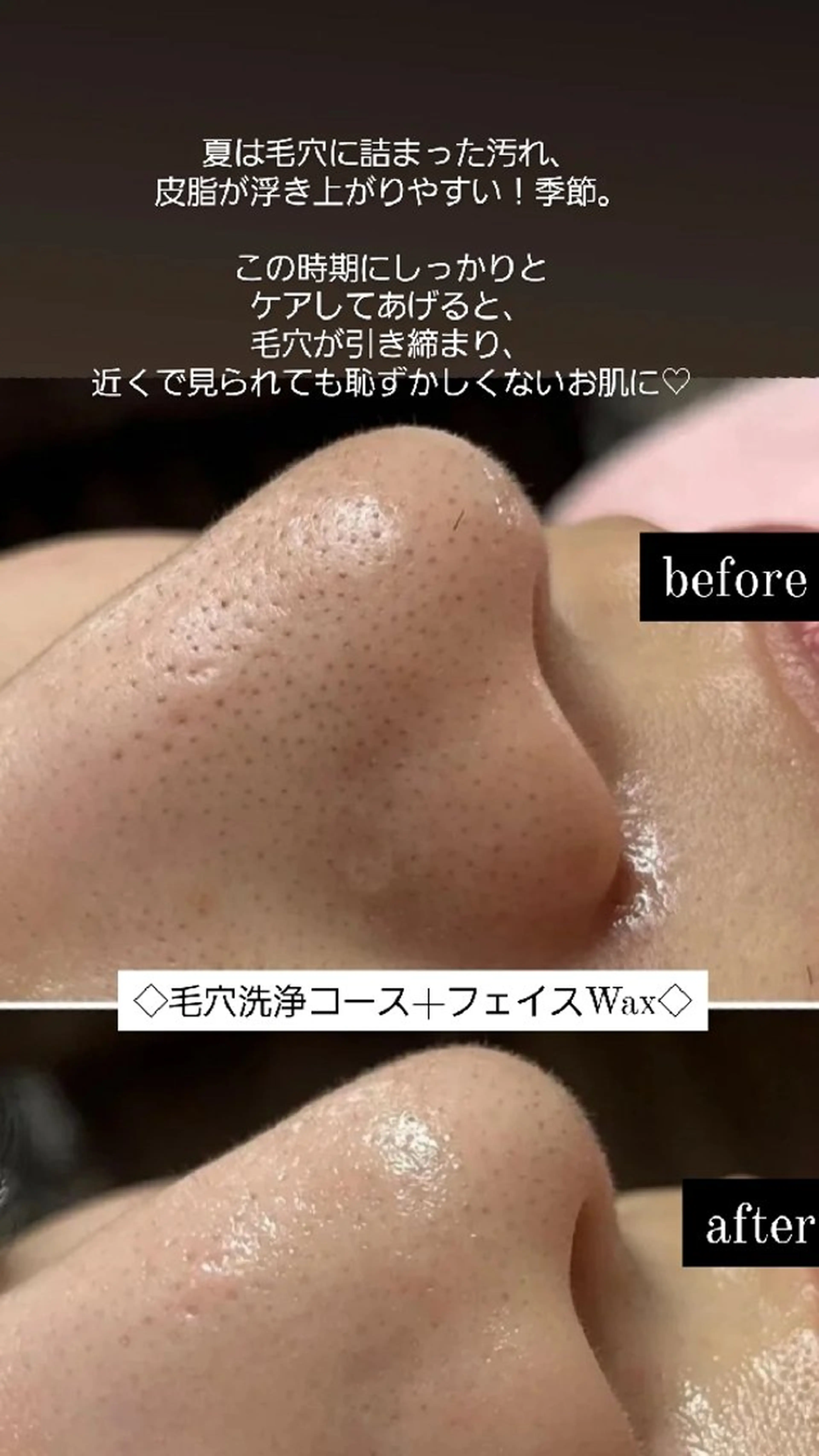 Premier 所属・寺西 さくらのエステ・リラクイメージ