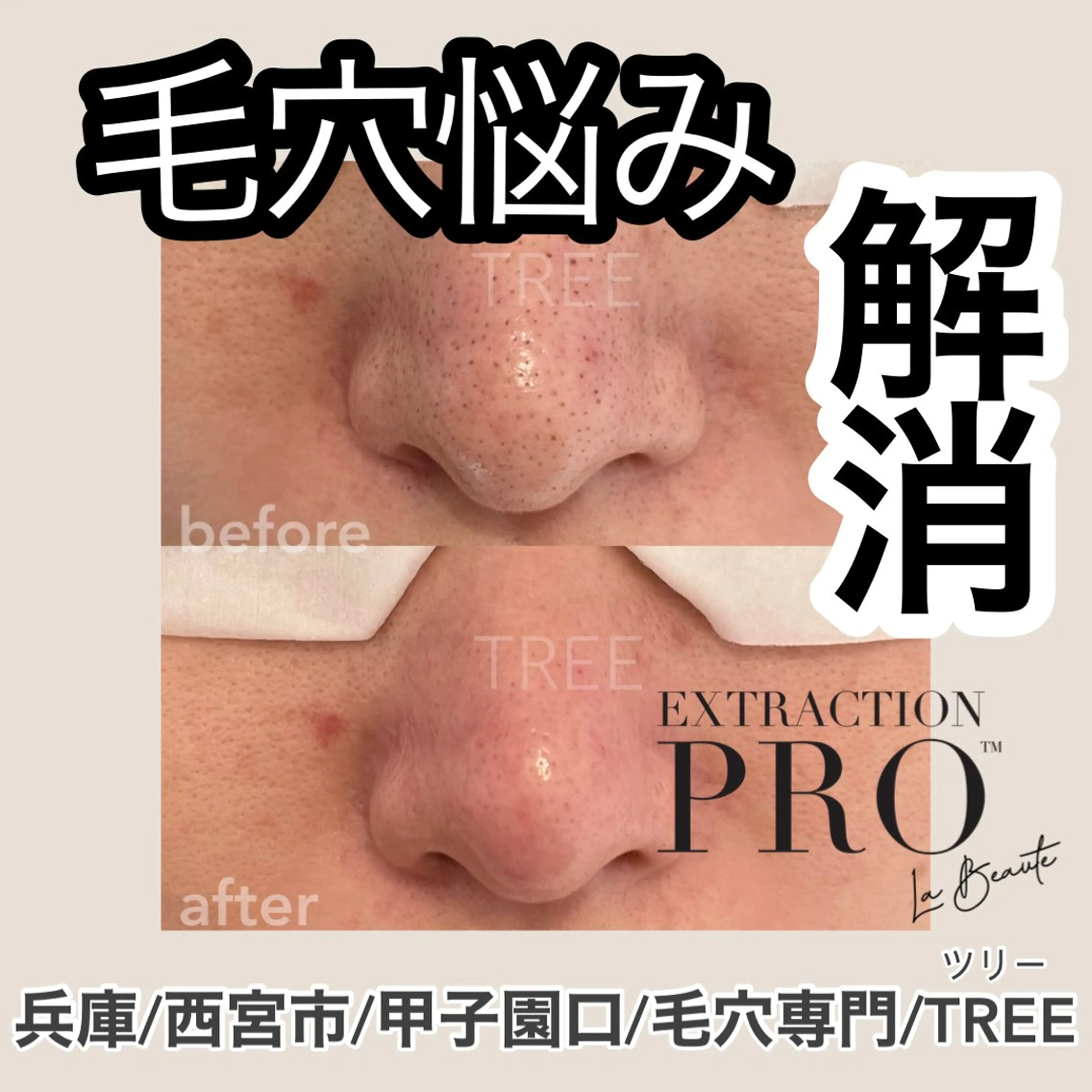 まつげ、毛穴 TREEのエステ・リラクイメージ