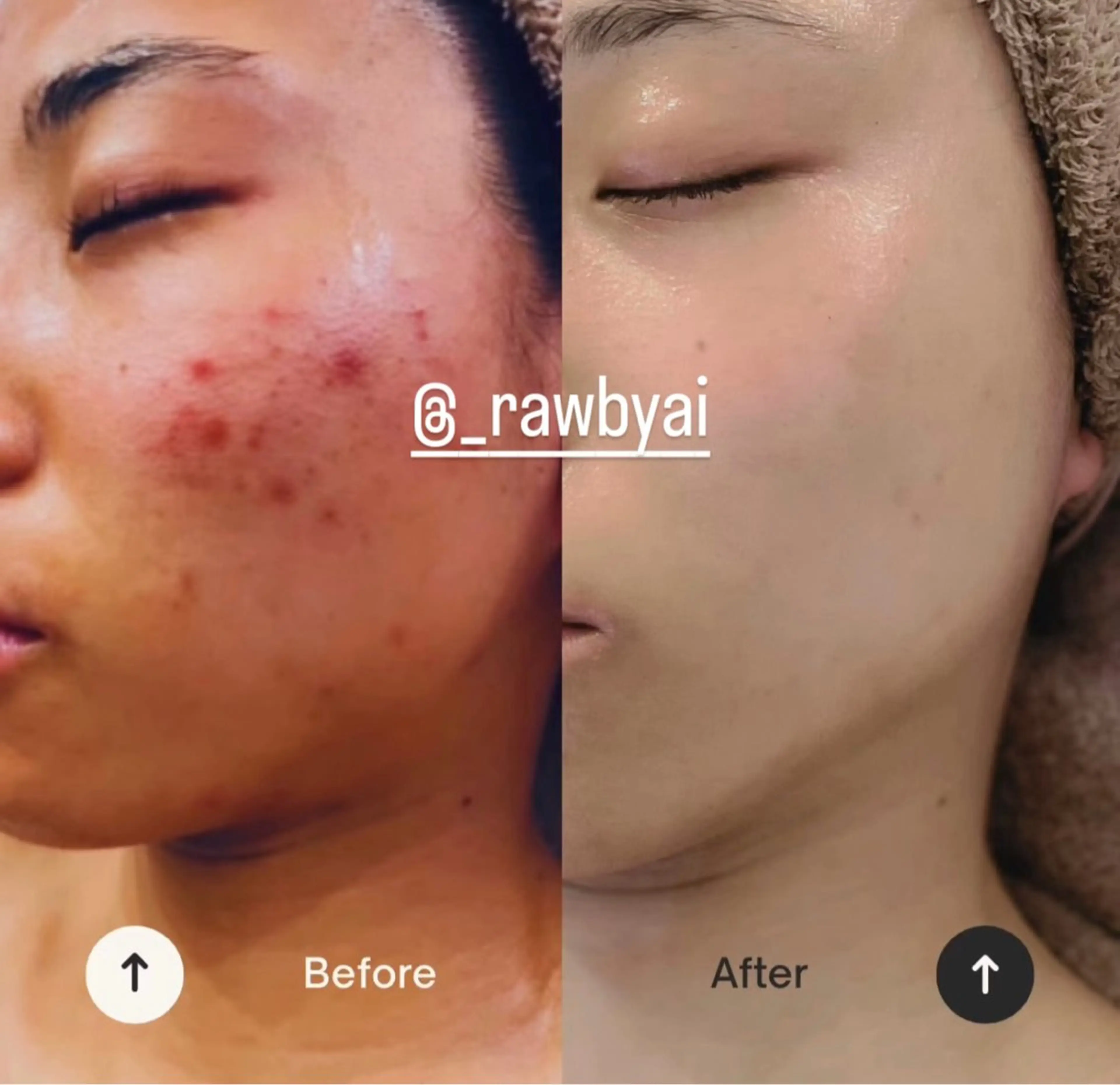 RAW.所属・RAW HARBのエステ・リラクイメージ