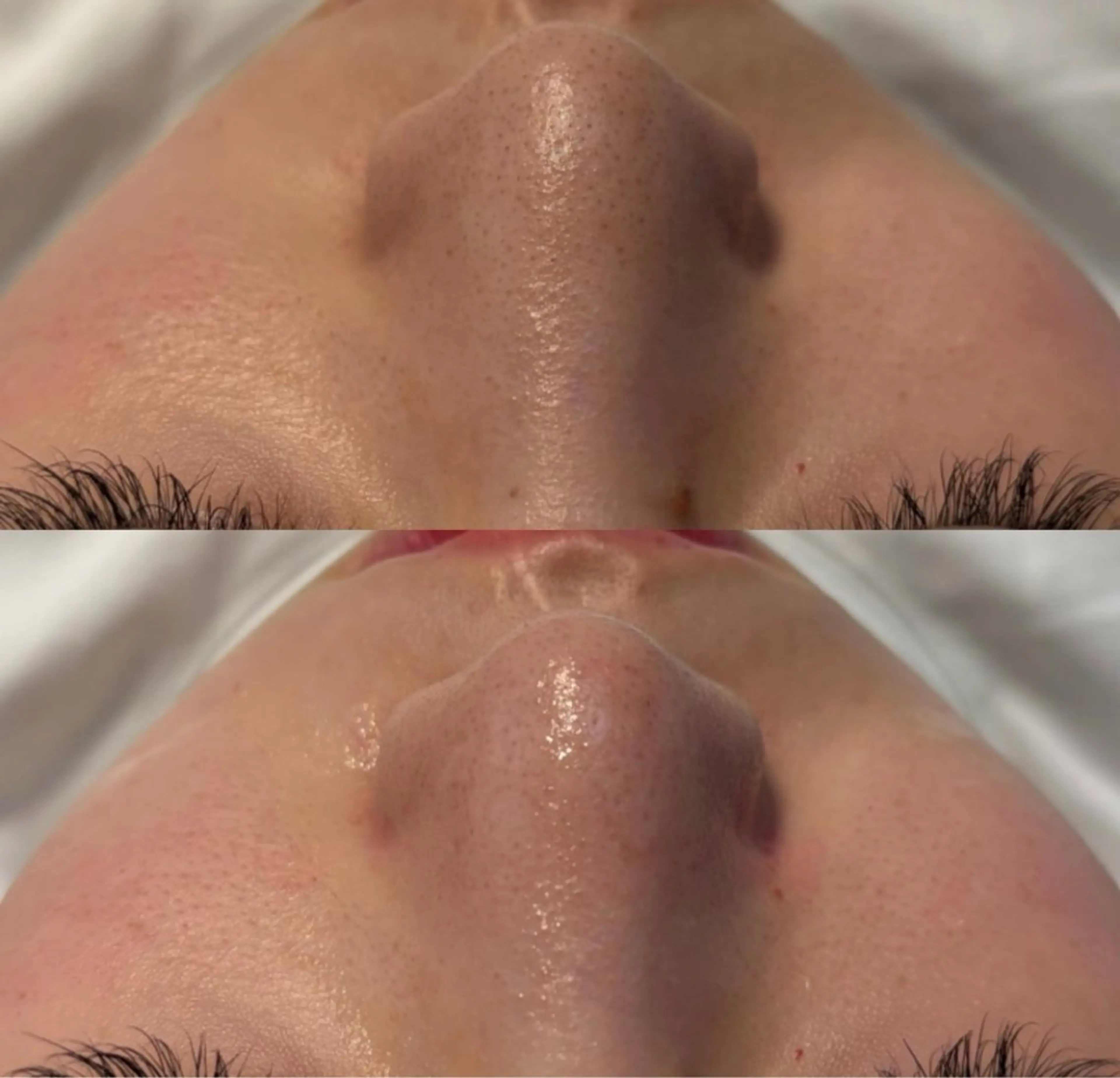 # fu♡のエステ・リラクイメージ