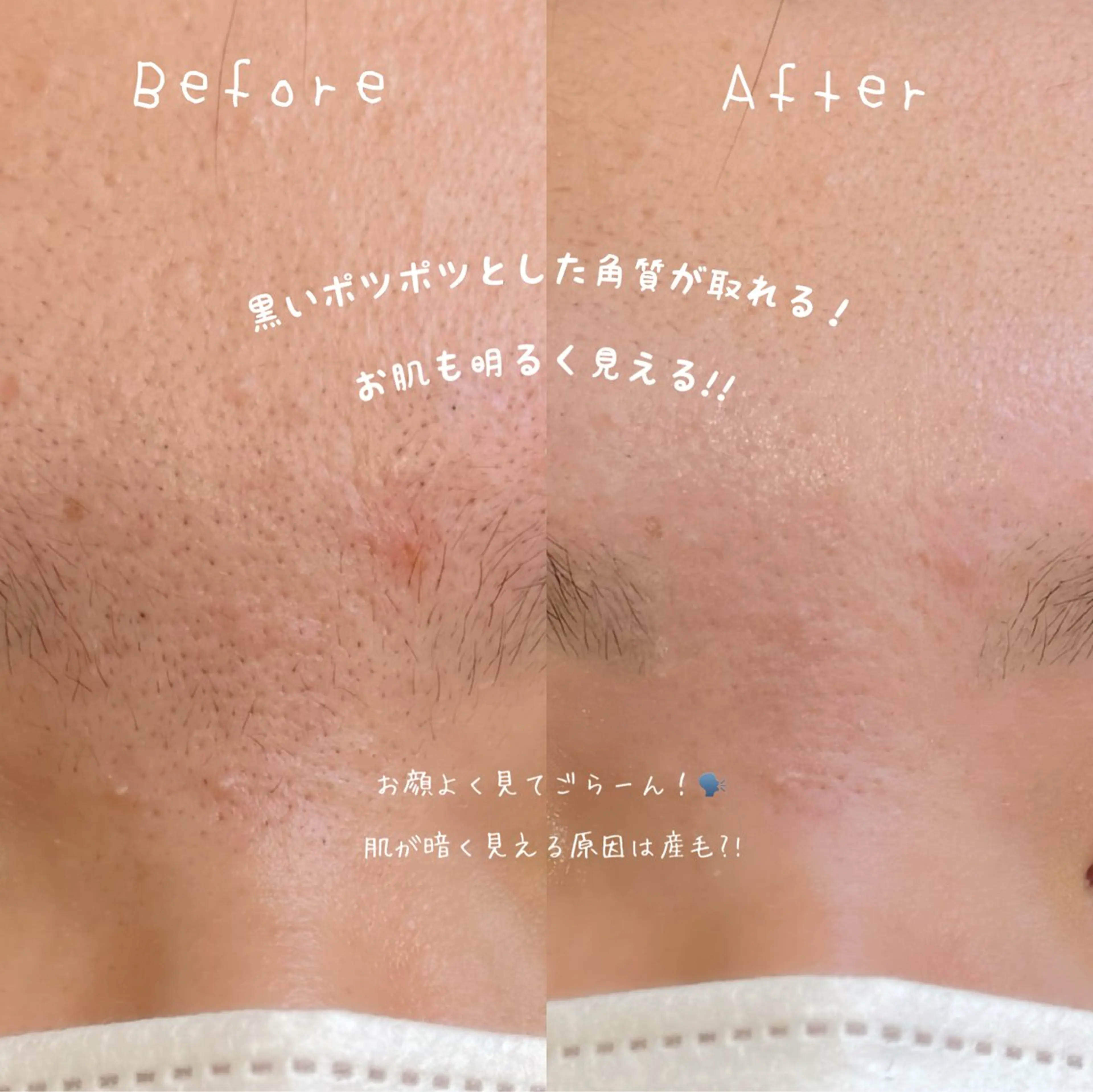 fors天王寺所属・Yuuka 🍫🍓のマツエク・マツパデザイン