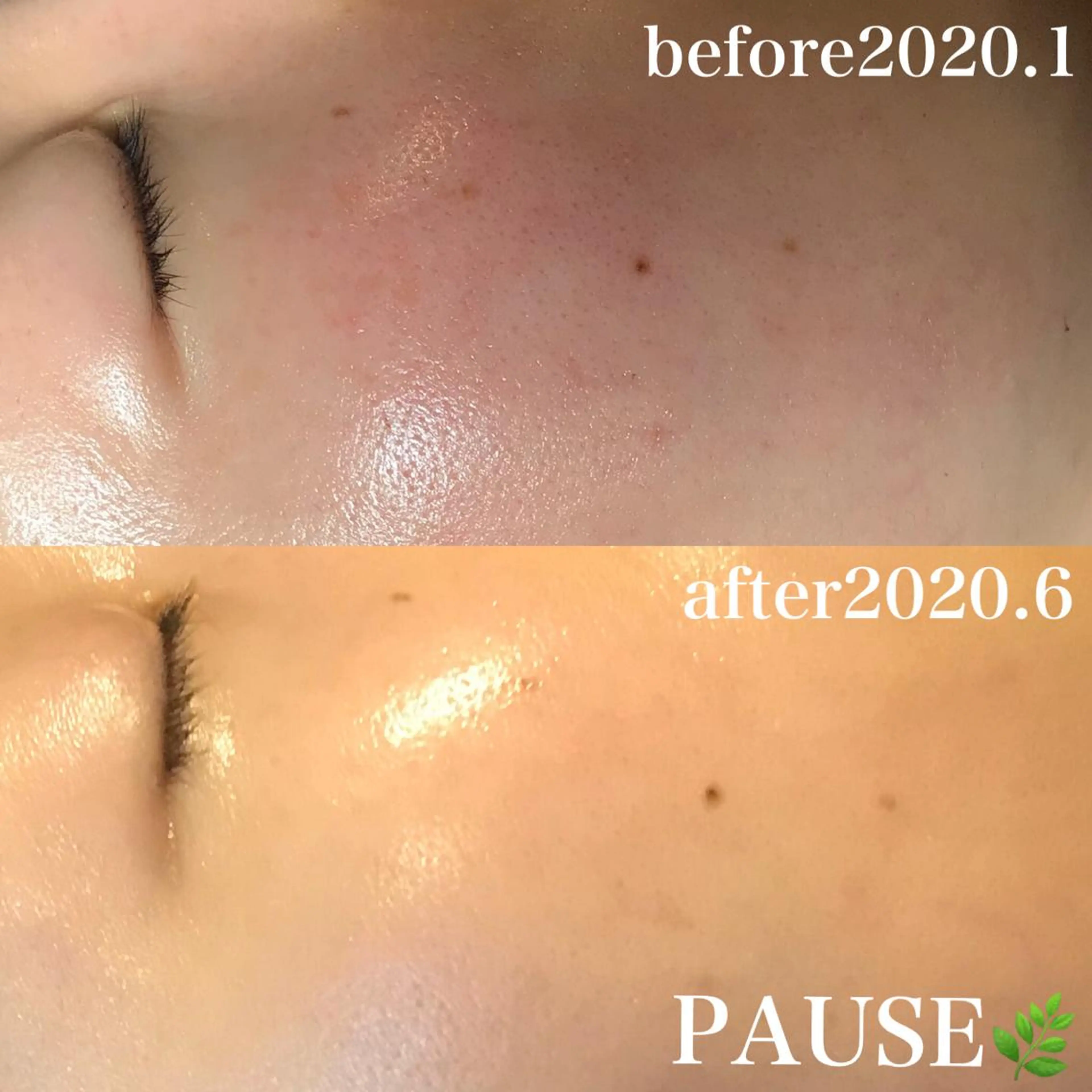 エステ 浜野 恵美のエステ・リラクイメージ