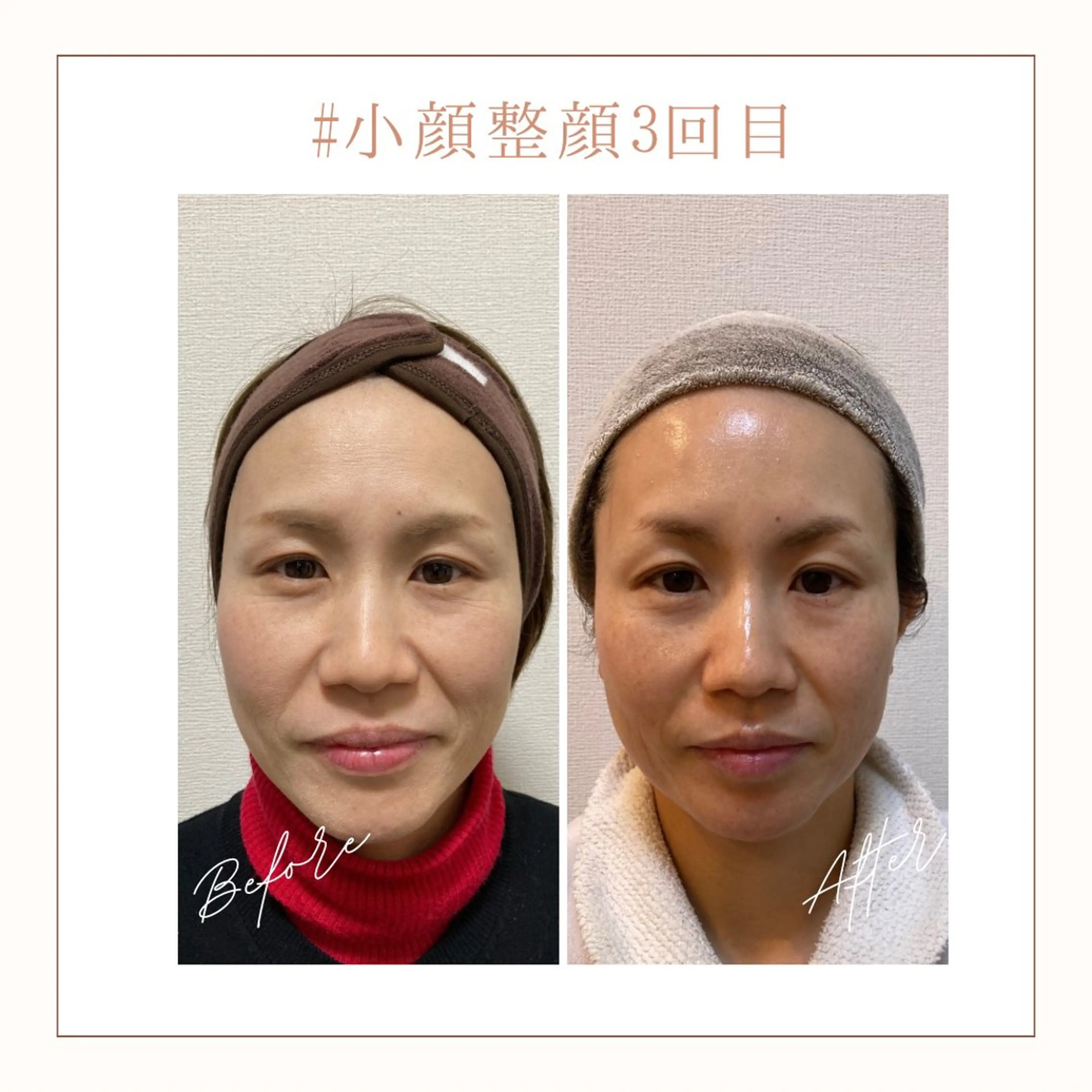 エステ リラク 小顔×肌質改善サロン soin〔ソワン〕のエステ・リラクイメージ