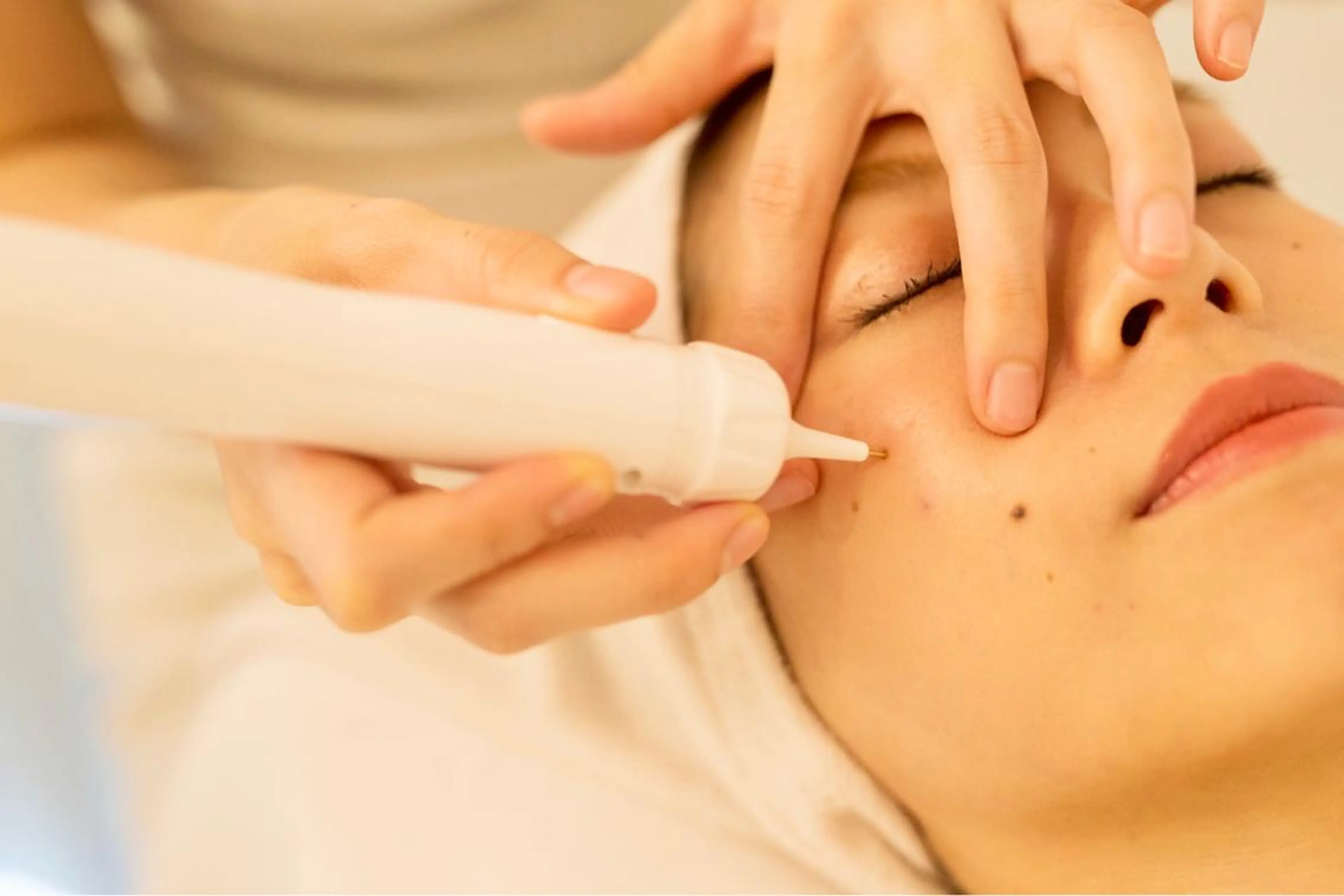 フェイシャル専門 肌質改善/プランスのエステ・リラクイメージ