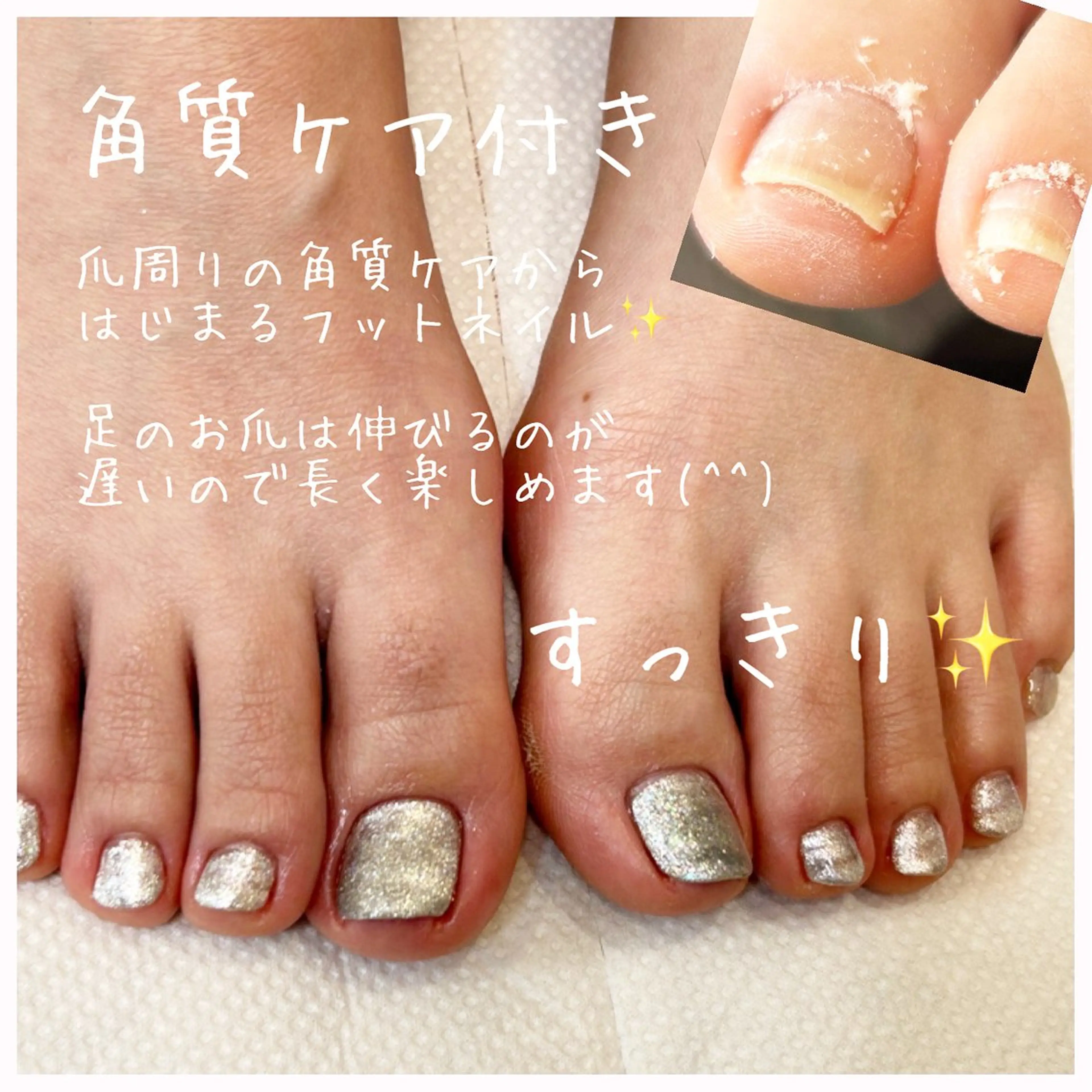 ネイル フットネイル ネイルサロン翼所属・ネイルサロン 翼【仙川4分】のネイルデザイン