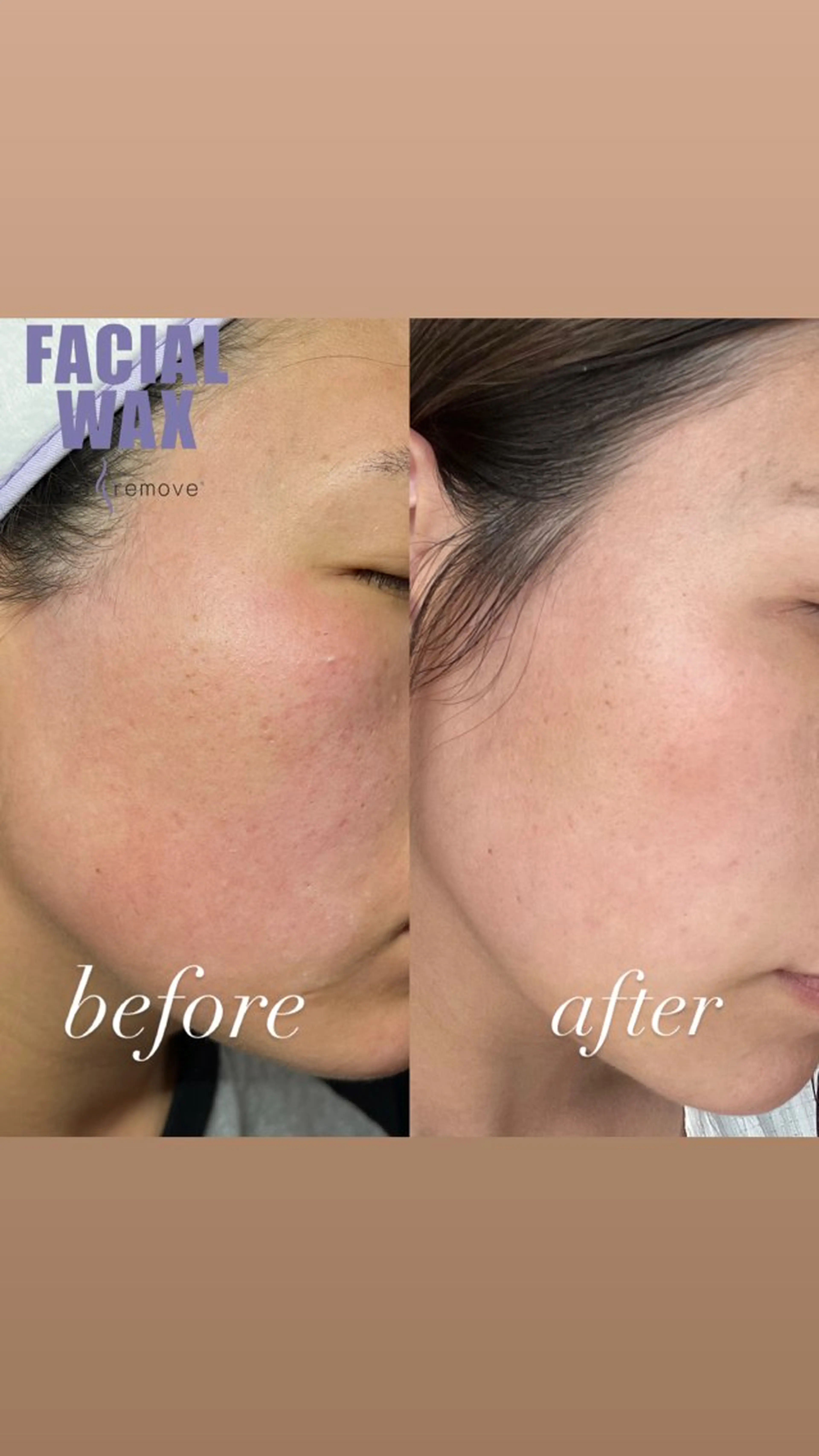 iti所属・iti 眉毛とワックス脱毛の眉毛・アイブロウイメージ