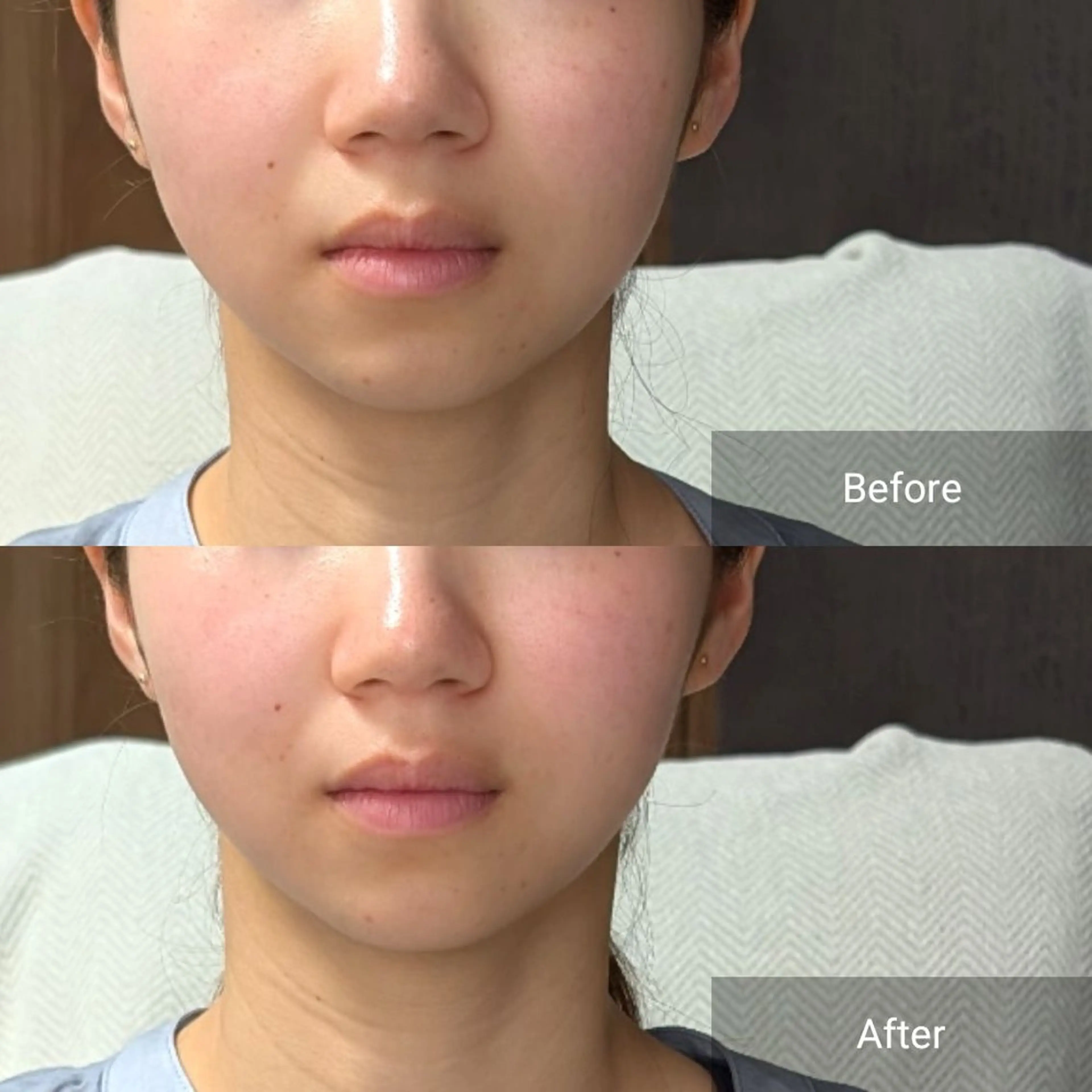 エステ nail RiRi アトレナチュラのエステ・リラクイメージ