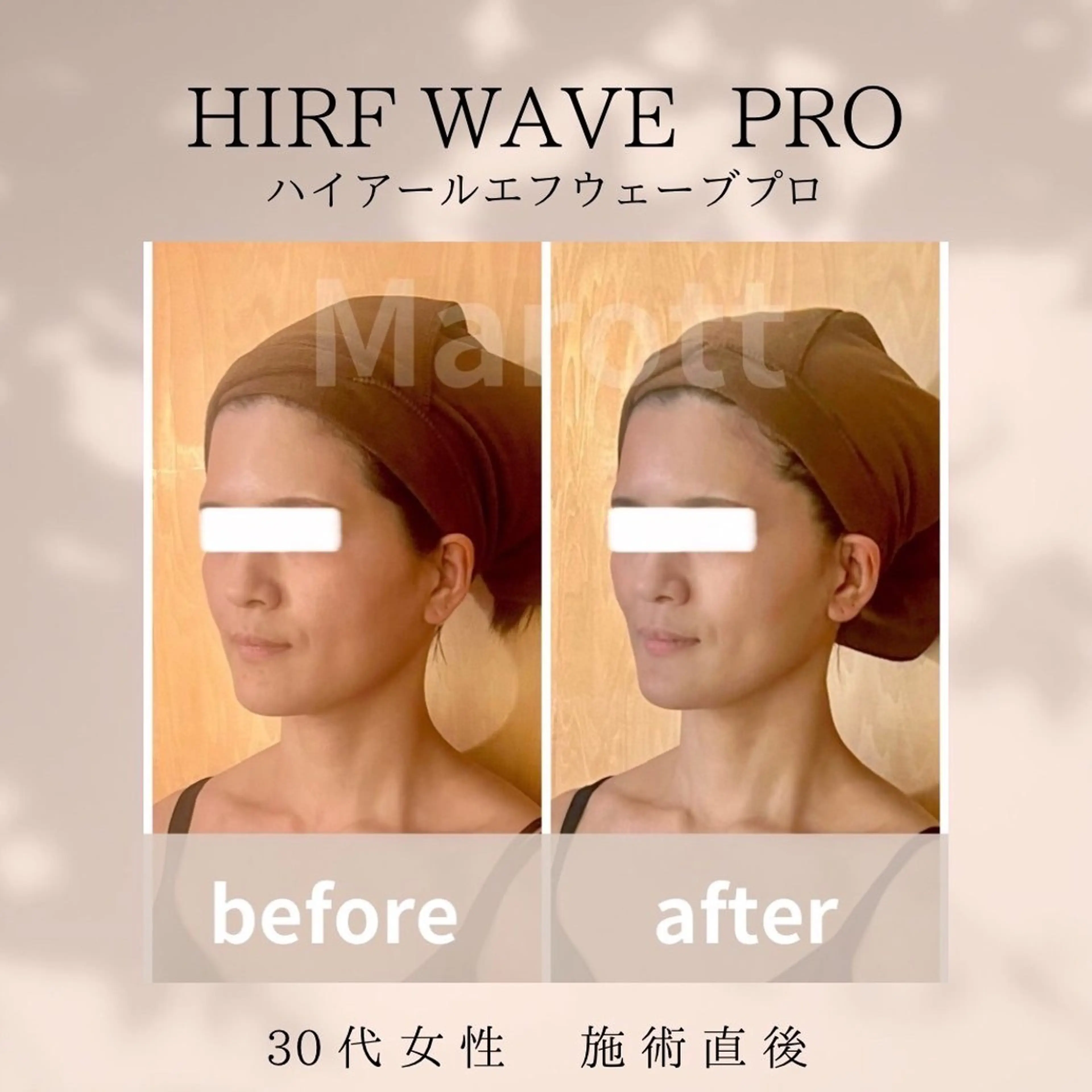 小顔サロン Marottのエステ・リラクイメージ