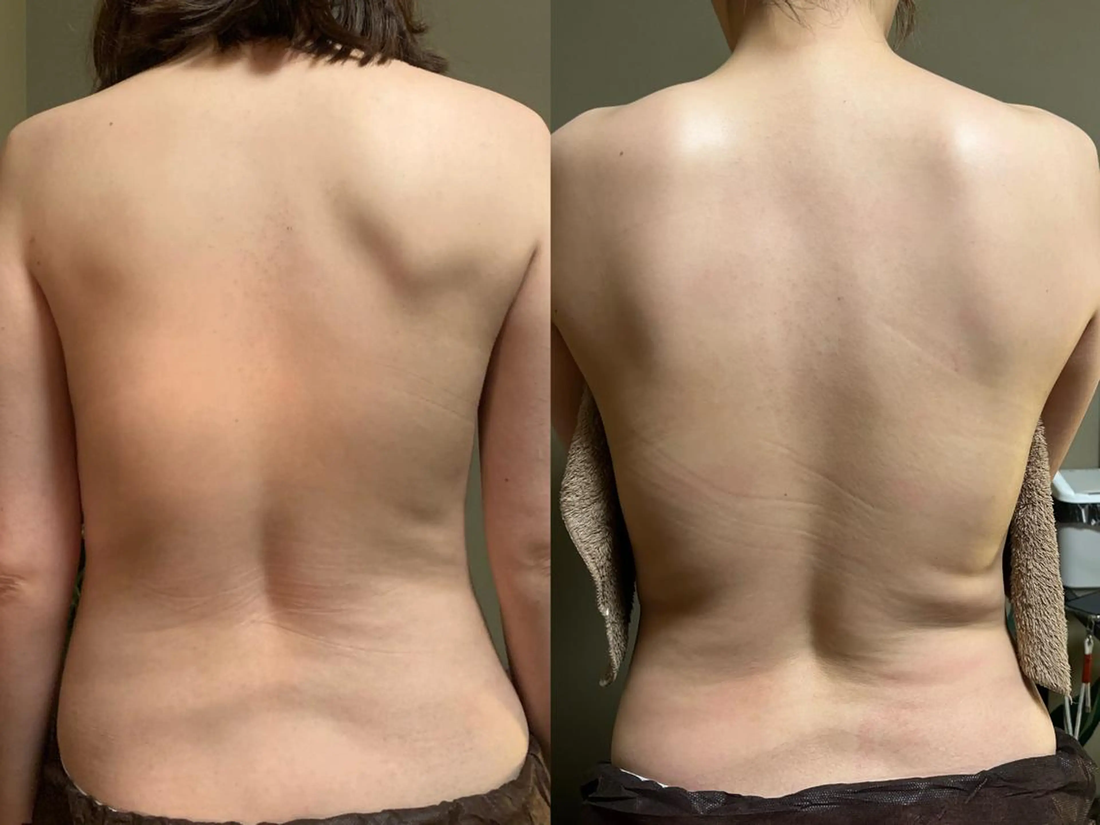 エステ リラク lymph care 'Welnəsのエステ・リラクイメージ