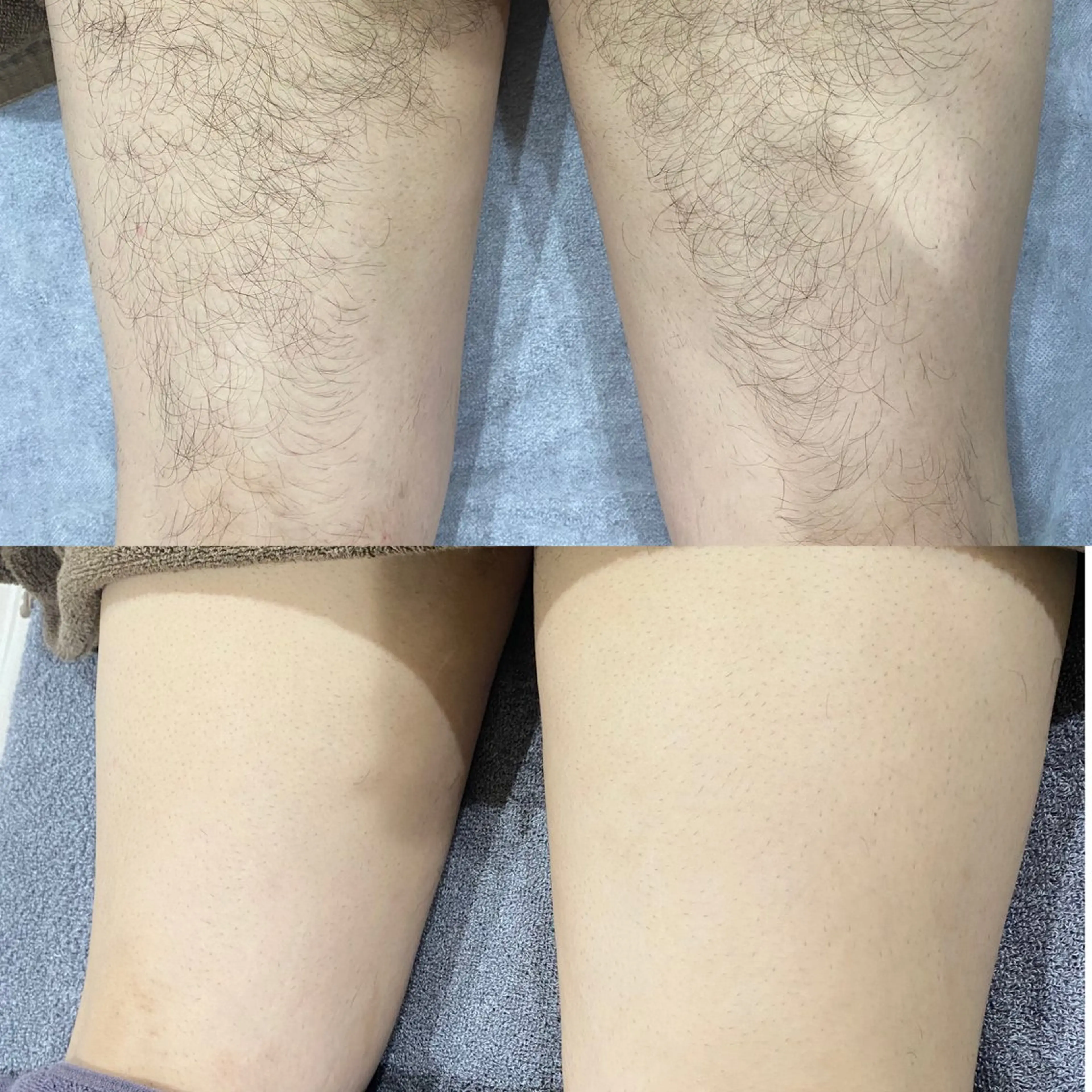 メンズ 脱毛 GALANTE beautysalon所属・泰中 郁未のエステ・リラクイメージ