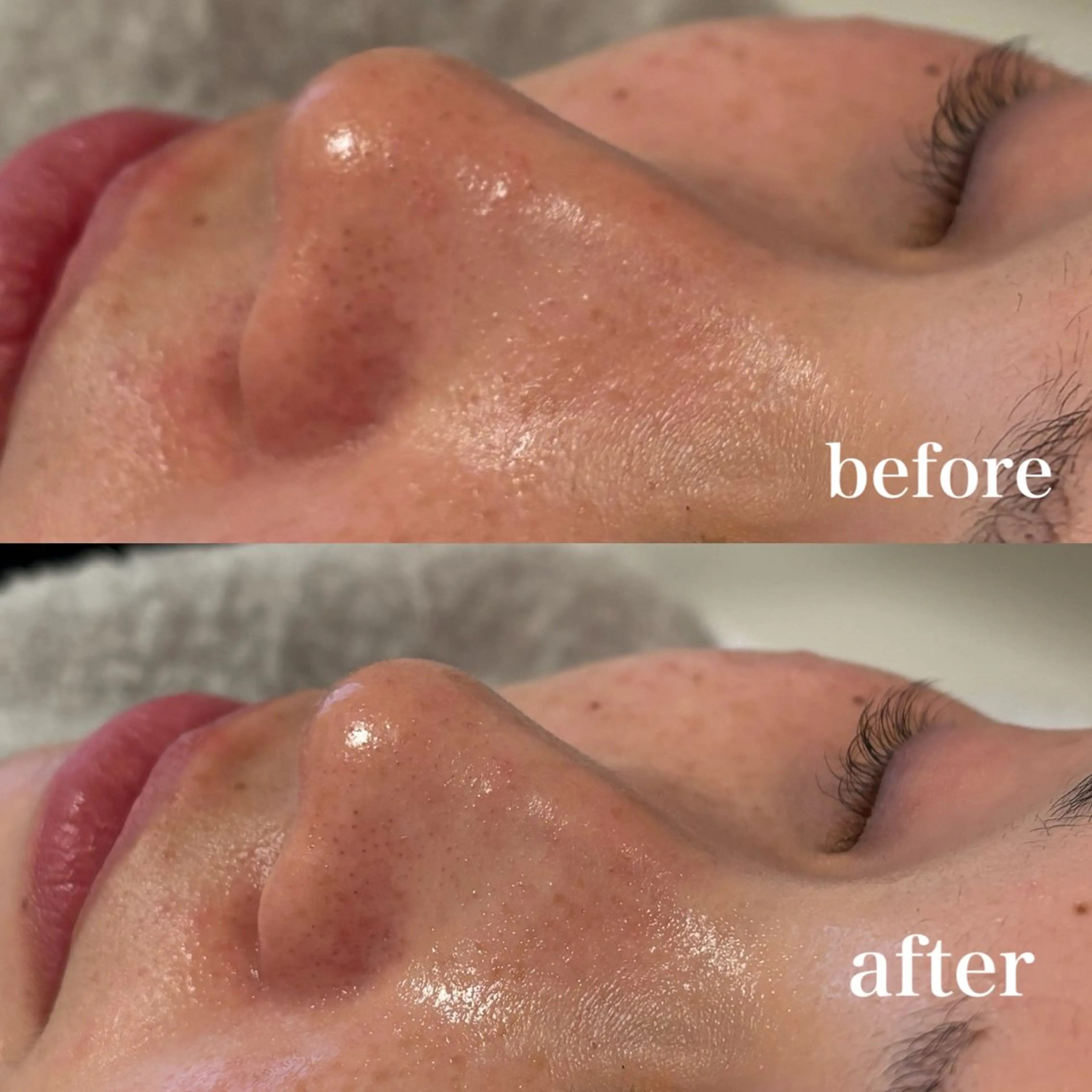 エステ 美養HAREHADA 🫧/ Ibukiの眉毛・アイブロウイメージ