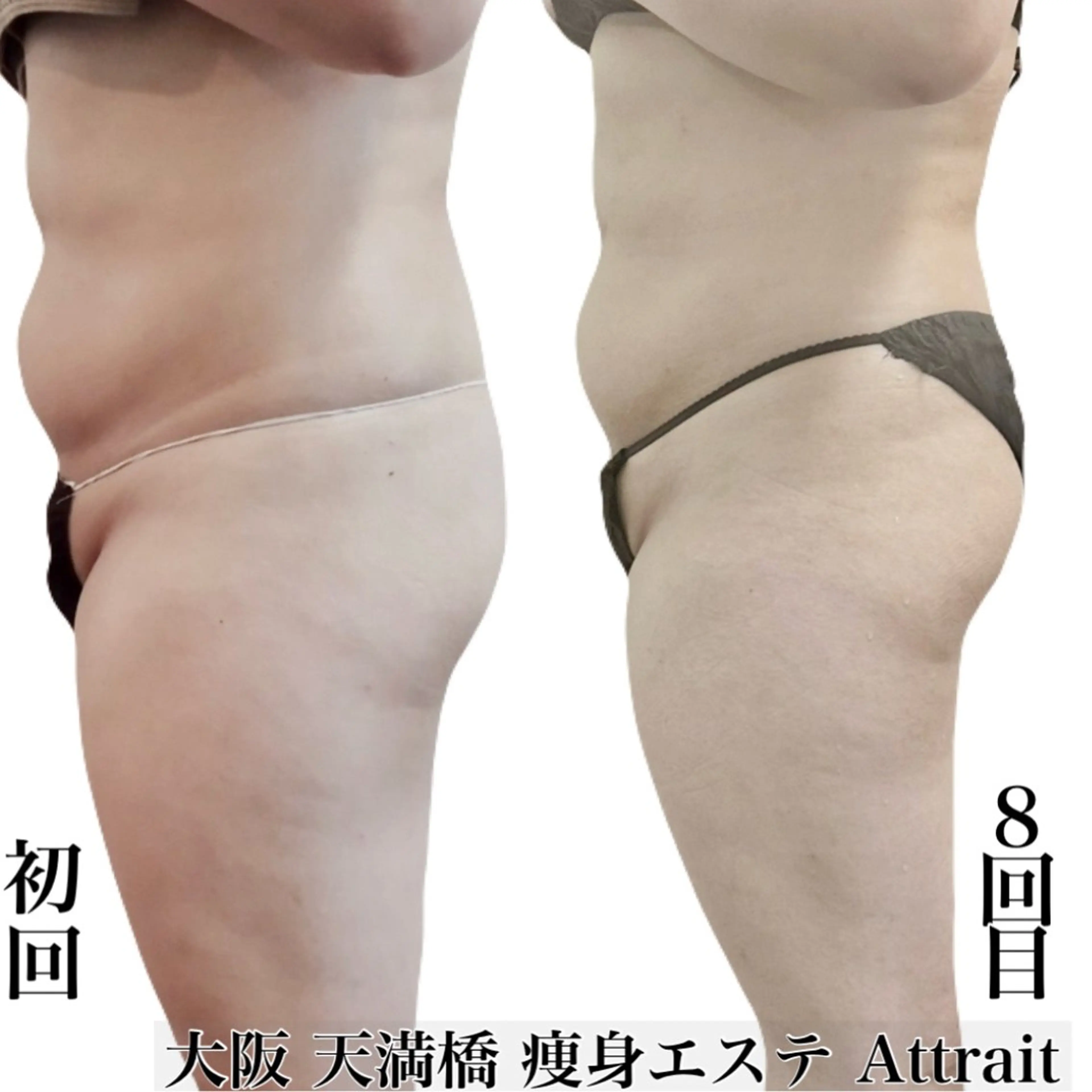 Attrait second body所属・30代体型•不調専門 天満橋Attraitのその他イメージ