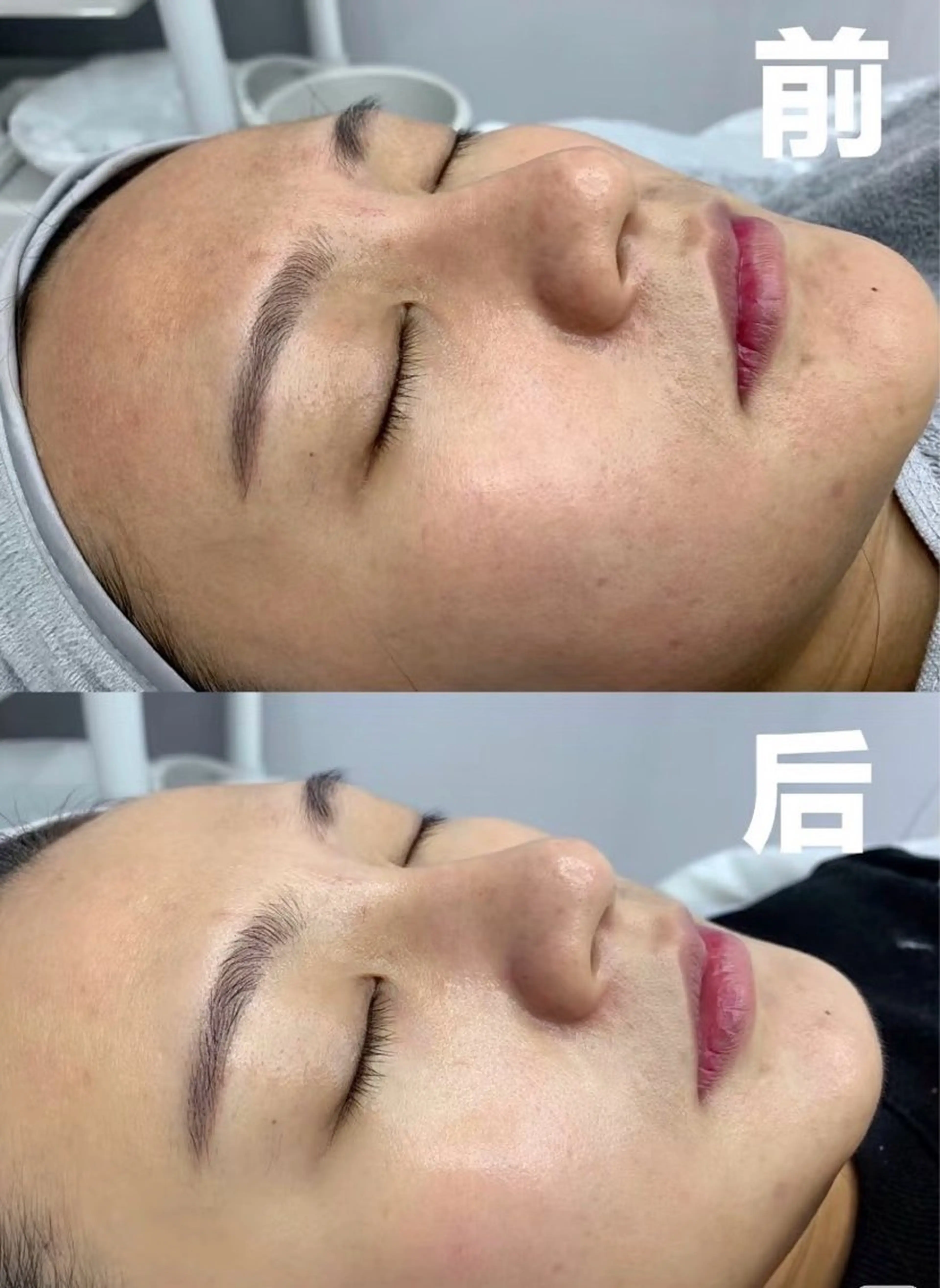 マツエク・マツパ エステ 愛維美水光美肌専門店所属・愛維美水光美肌専門店 メンズレディースokのエステ・リラクイメージ