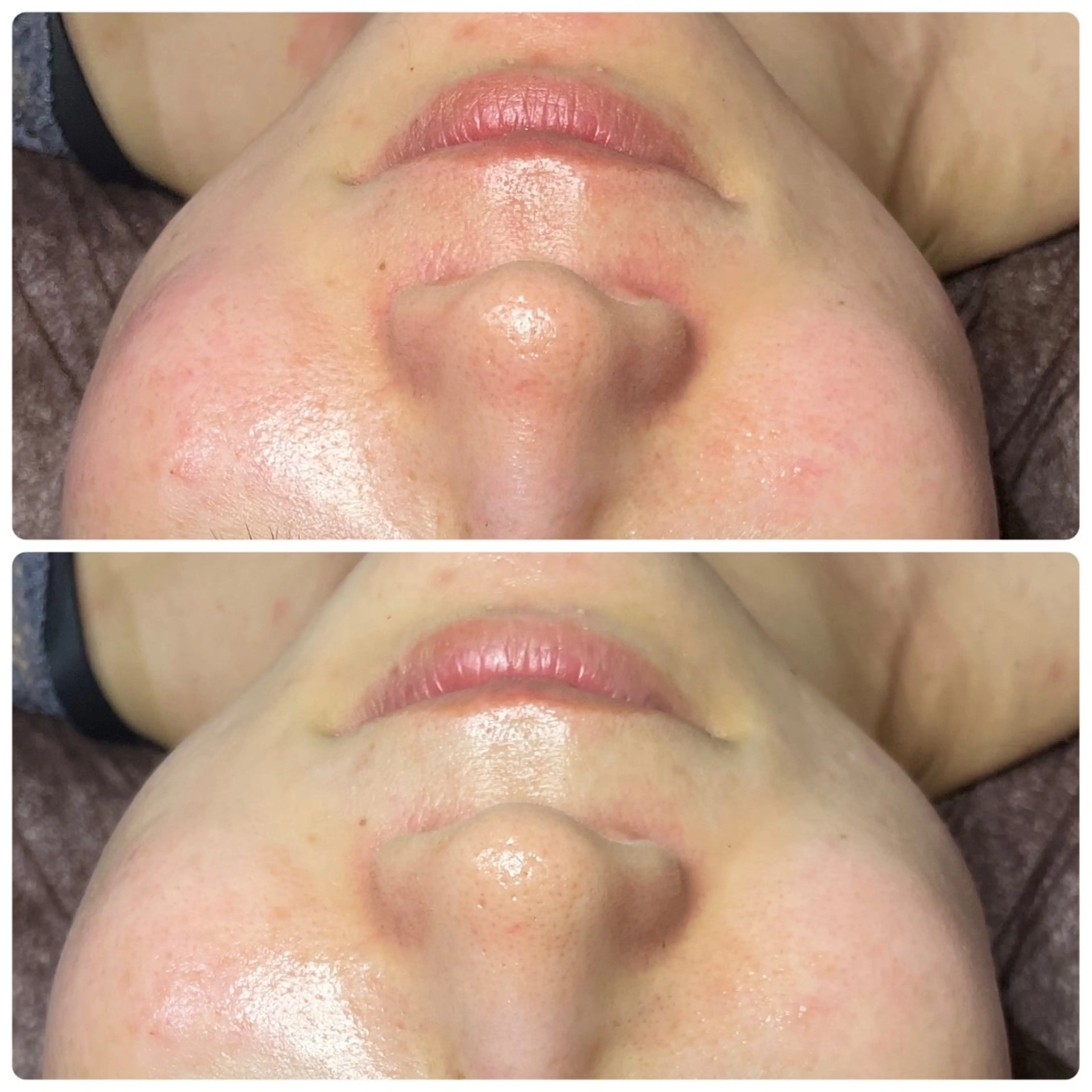 エステ 肌育脱毛サロン LikoLinaのその他イメージ