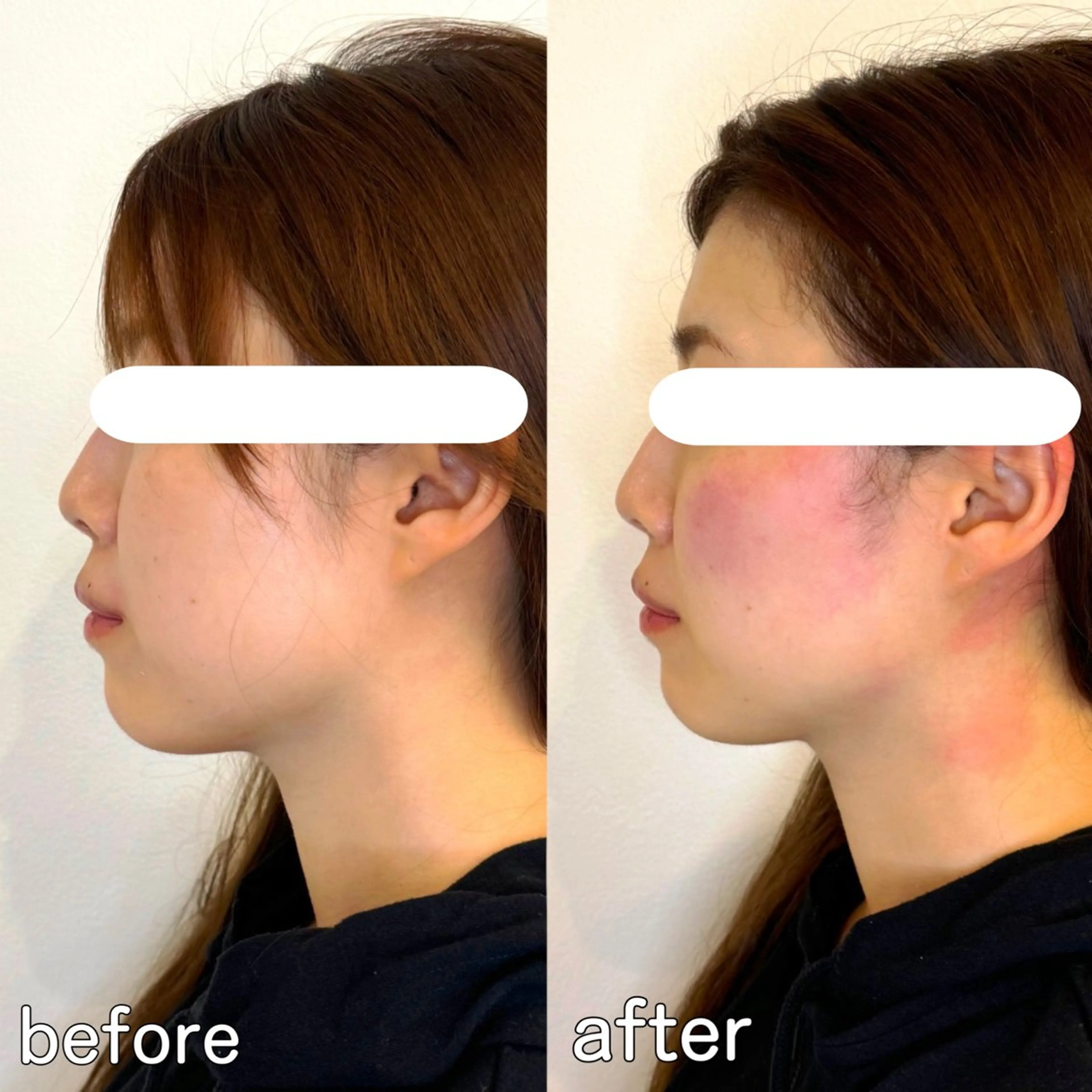 小顔矯正&美容整体 整え屋REDオーナーのエステ・リラクイメージ