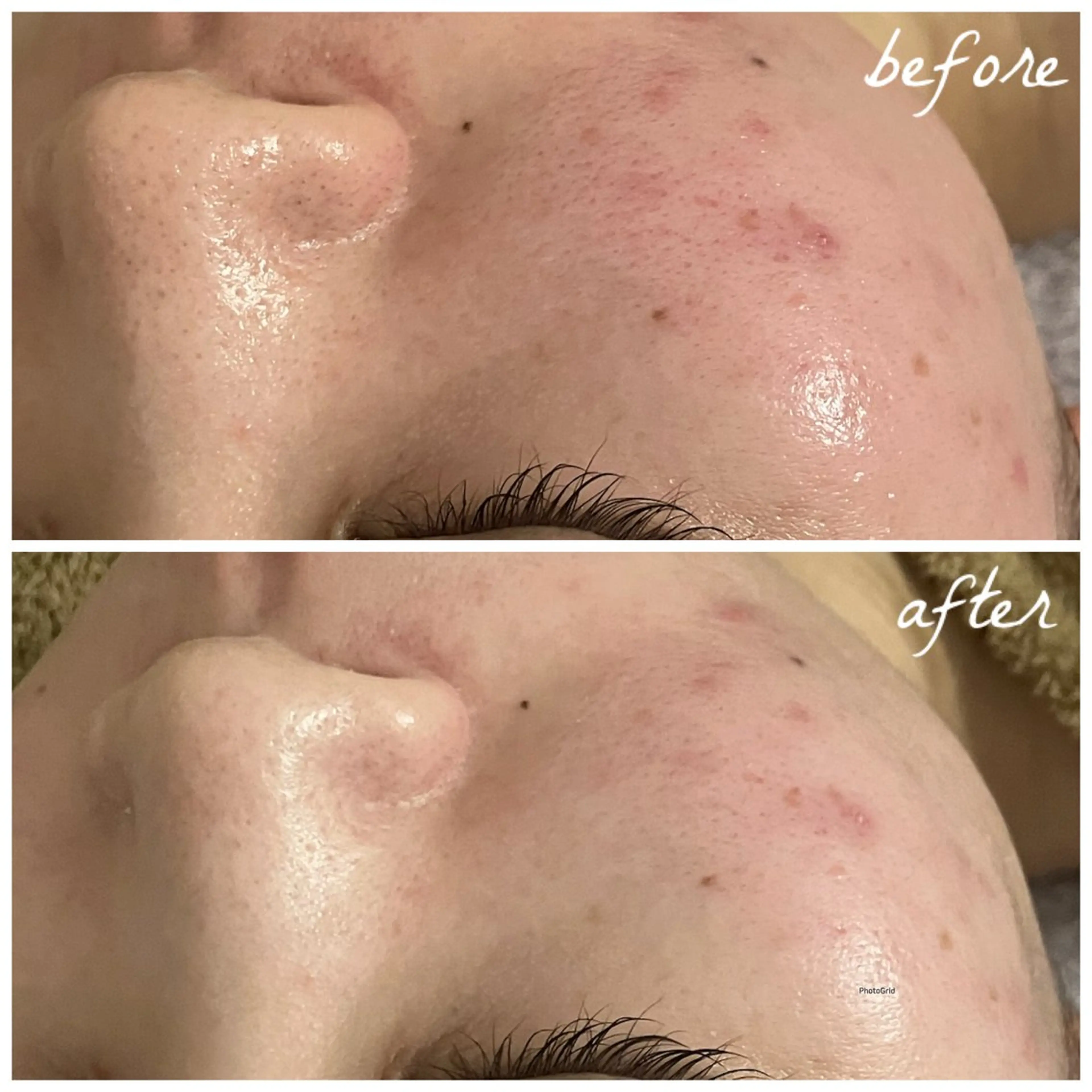 メンズ エステ メナード岐阜茜部 杉浦のエステ・リラクイメージ