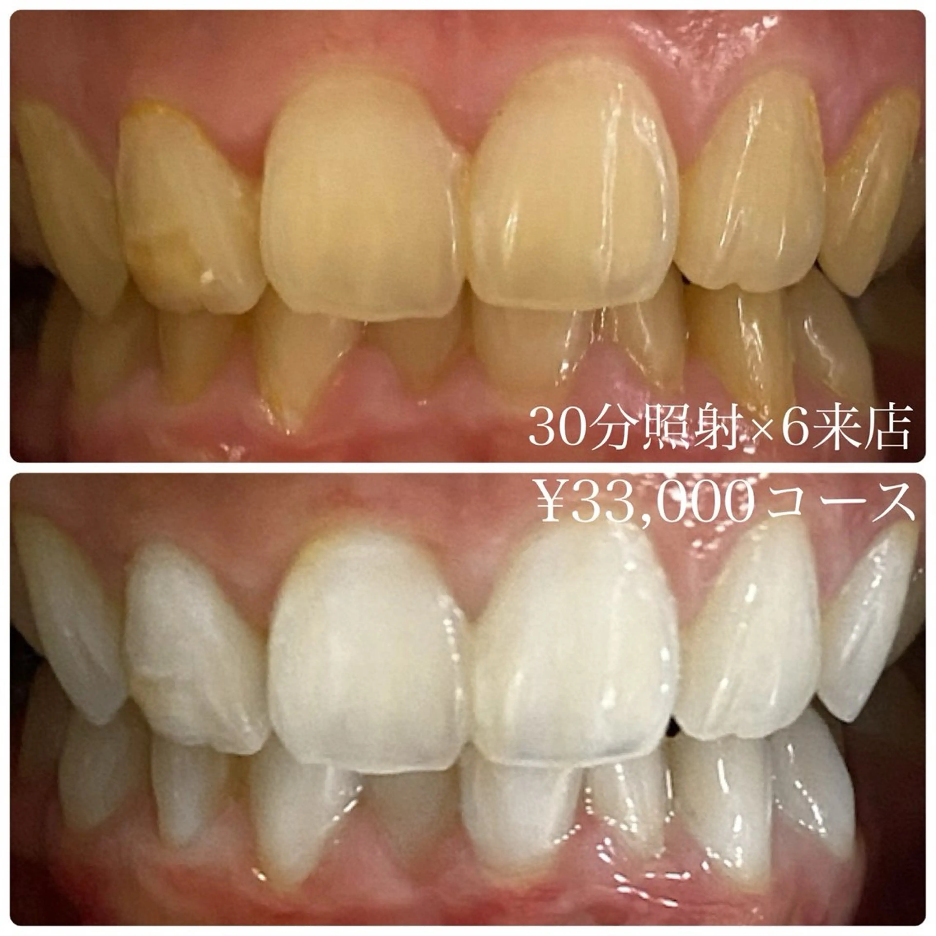 その他 PLATINUM Beauty 横浜店所属・ホワイトニングルーム 横浜店のその他イメージ