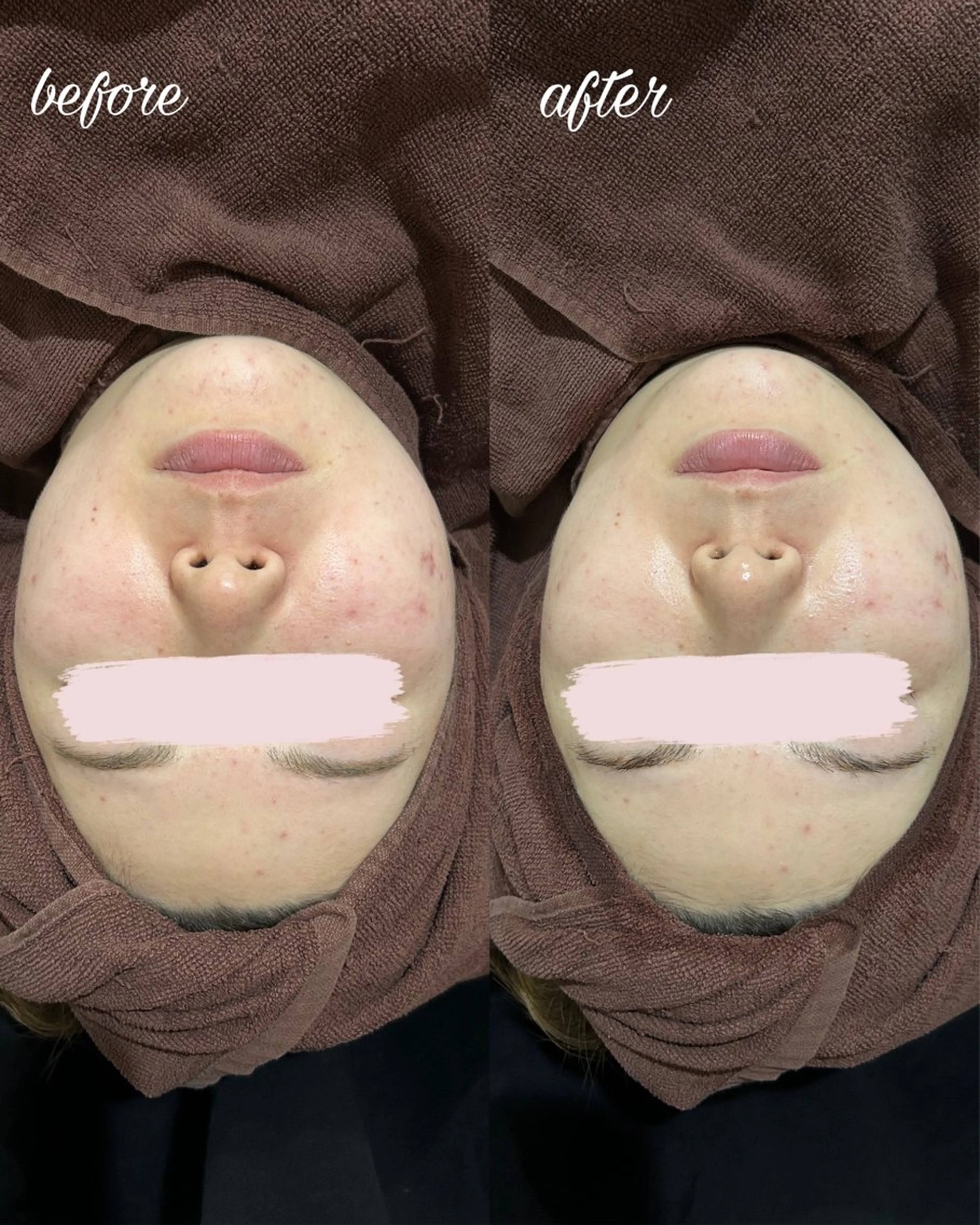 マツエク・マツパ アイリッドアップパーマ マツパ merveilles所属・まつげ/整体/にきび ・アトピー専門サロンのマツエク・マツパデザイン