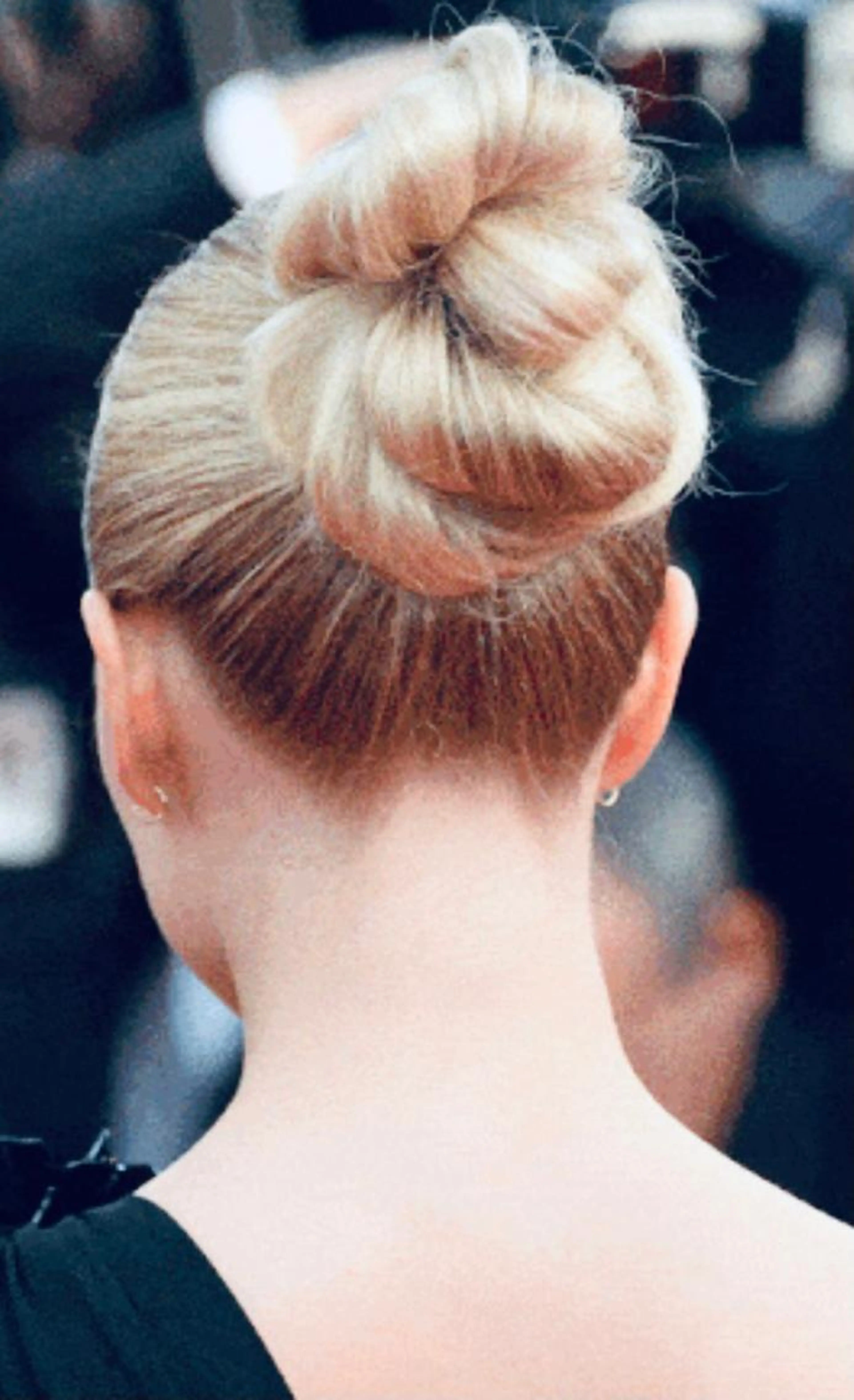 【うなじ脱毛】　バックスタイルも美しく.｡.✨成人式に向けて.｡.💐の写真