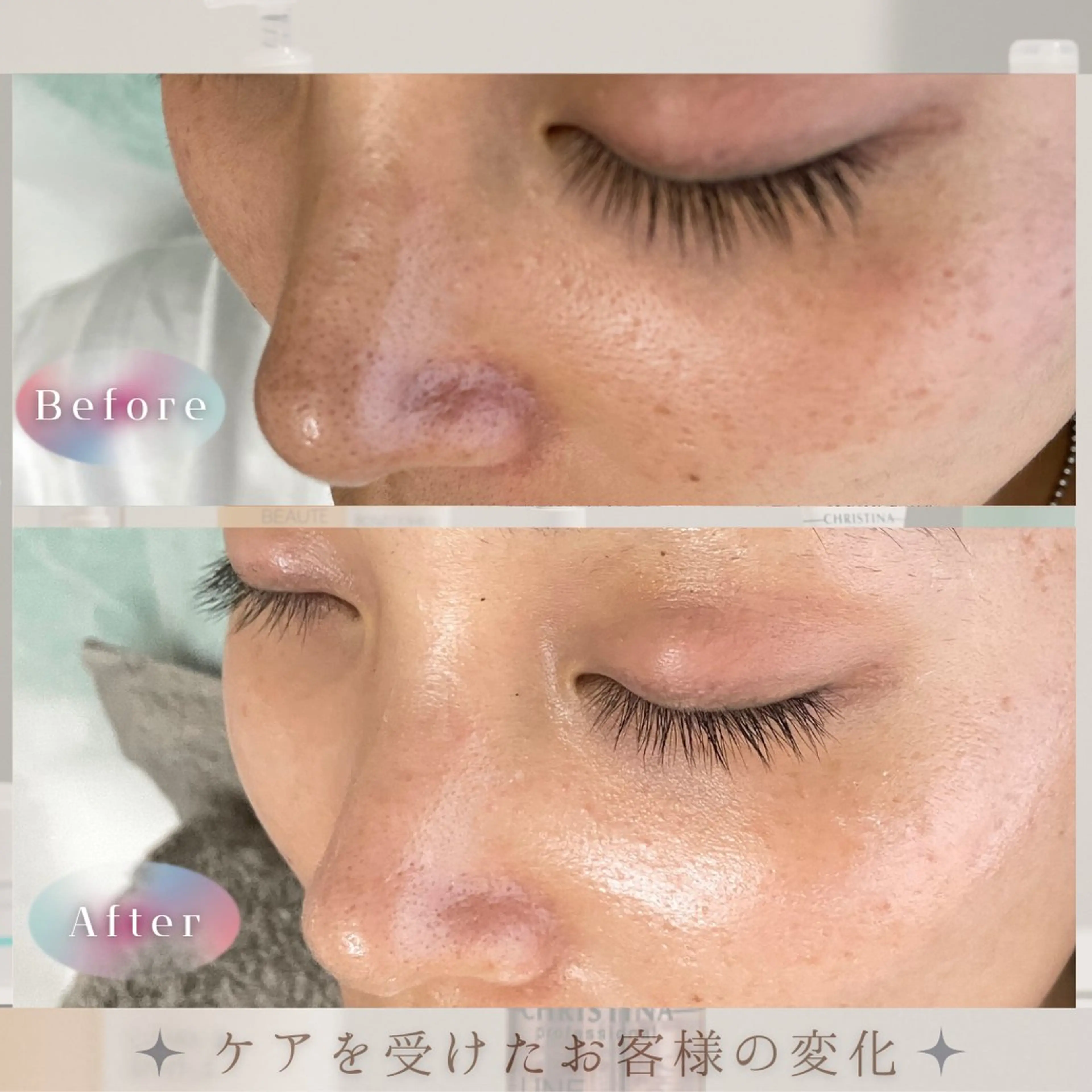 LBSホワイトニング 🌐岡山店のその他イメージ