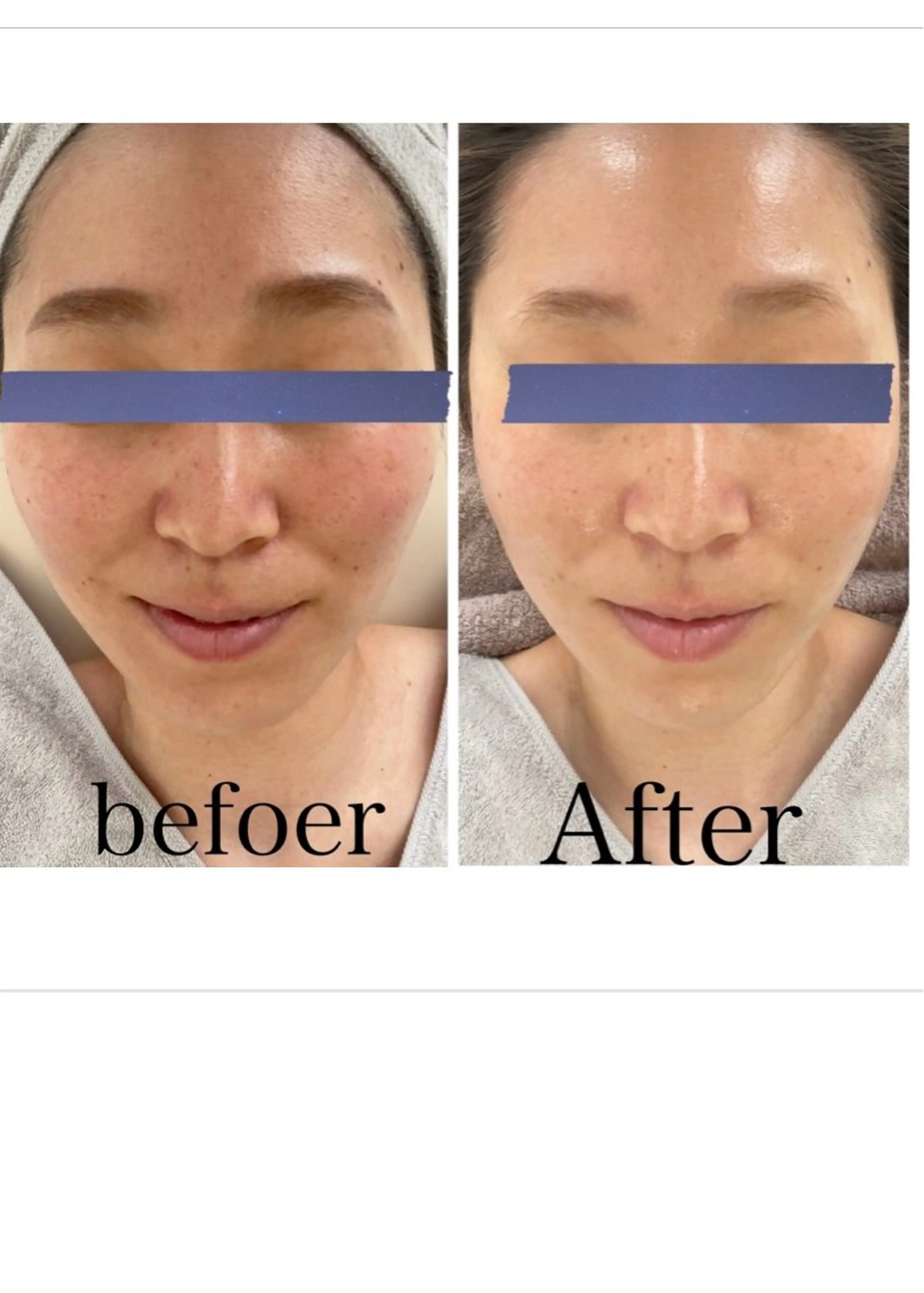 エイジングケア専門店 richbelle所属・エイジングケア専門 richbelleのエステ・リラクイメージ