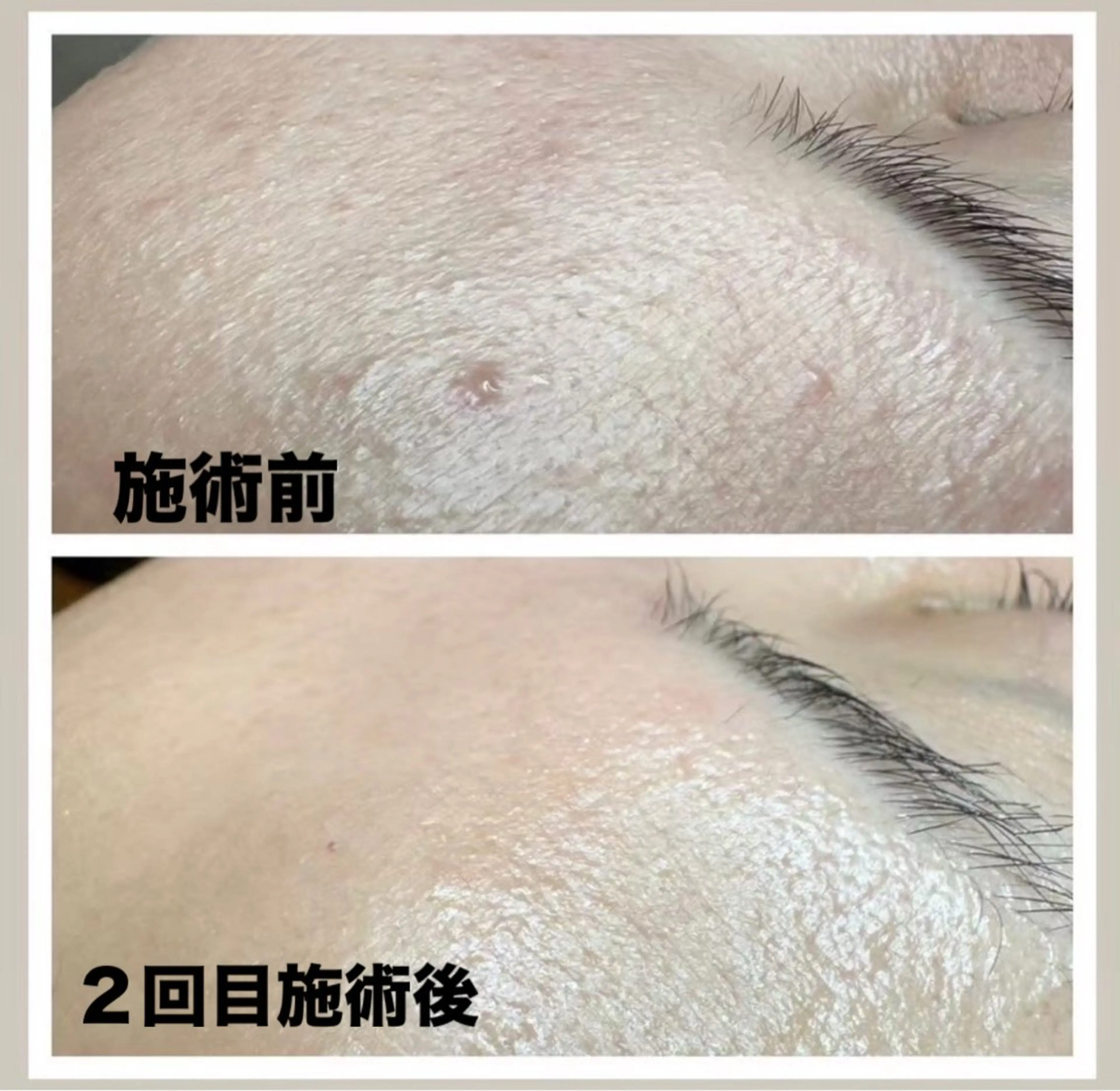 スリーエスプラス内　美肌サロンEme所属・希映 -kieのエステ・リラクイメージ