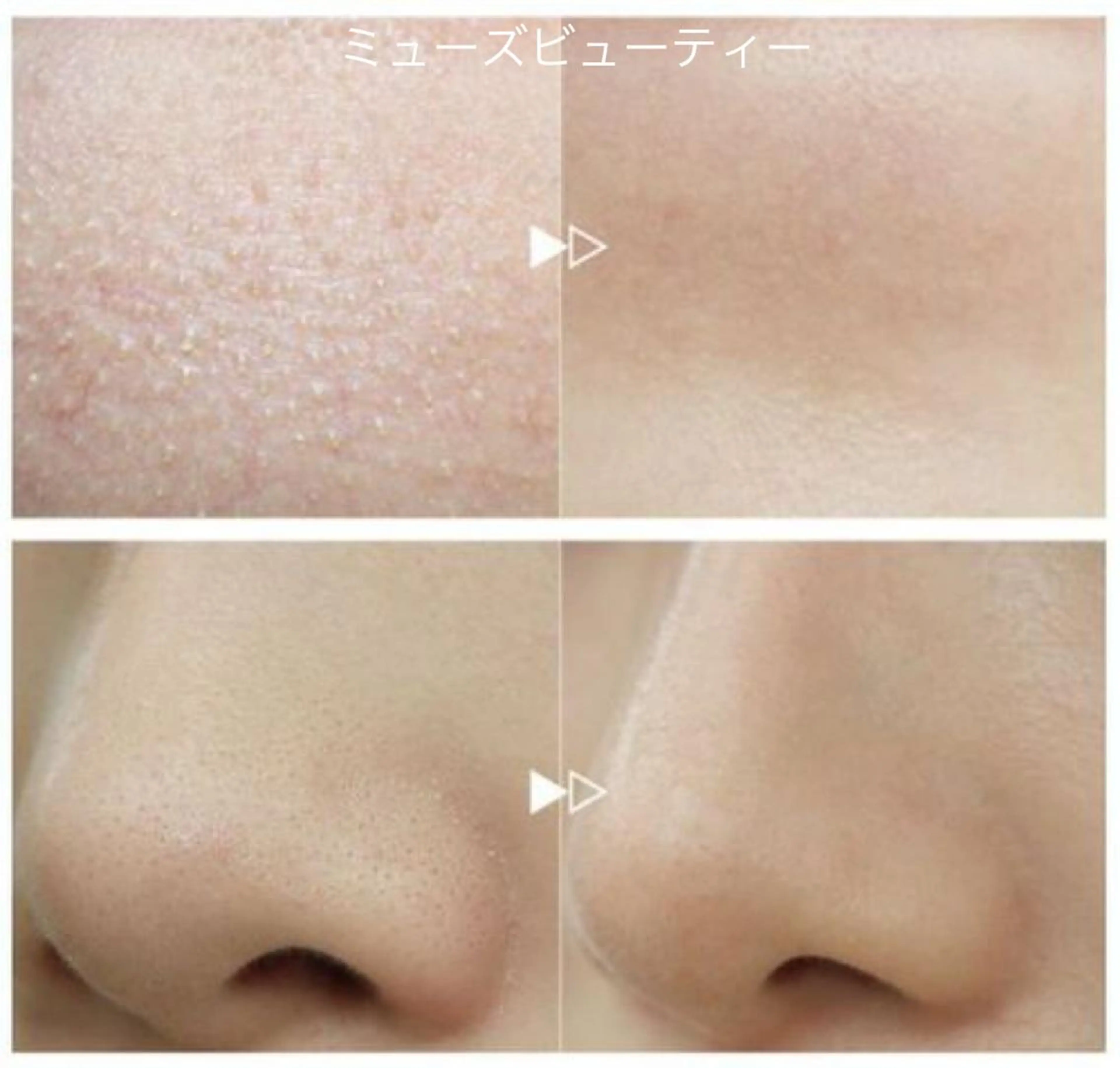 エステ ミューズビューティー所属・山本 ゆりのエステ・リラクイメージ