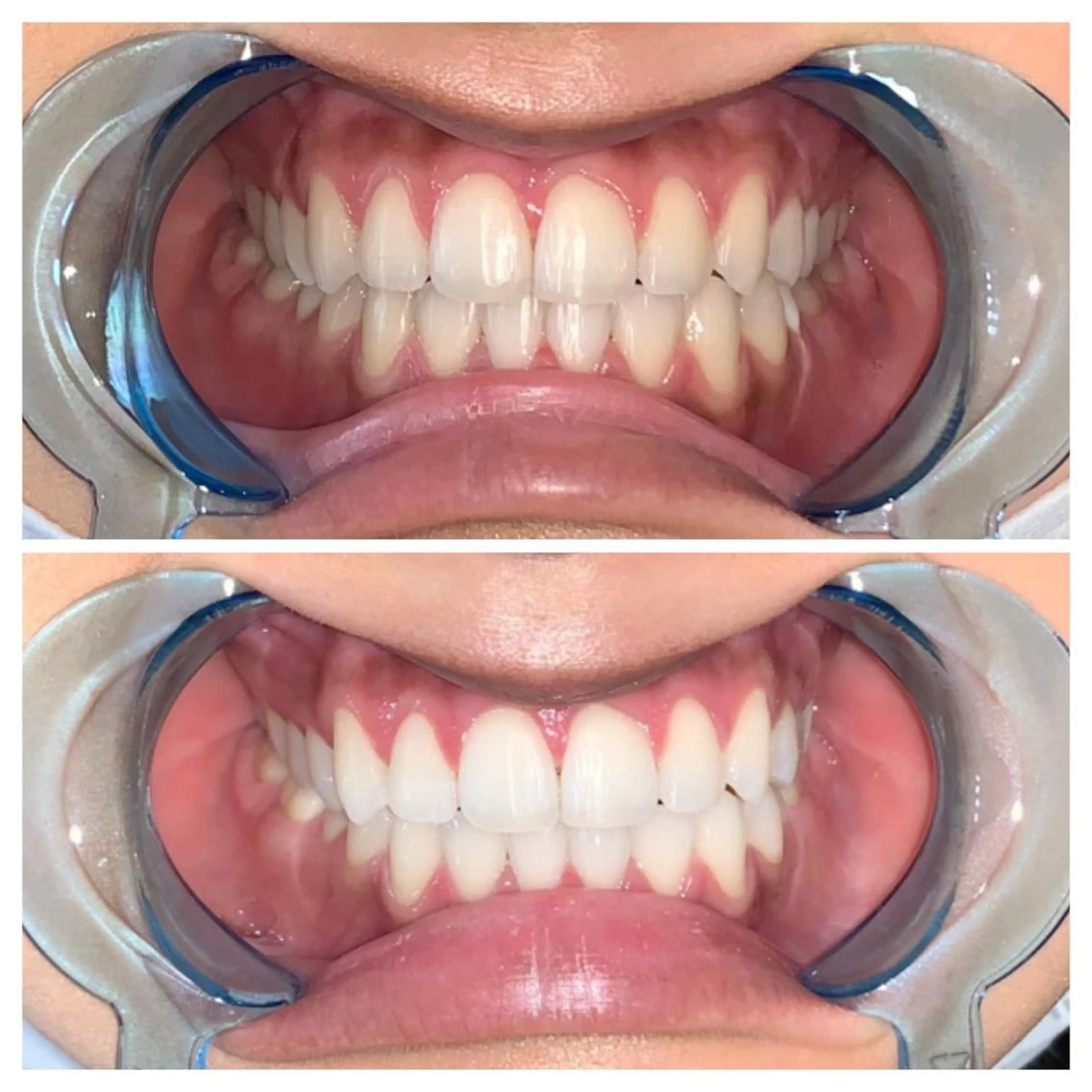 ネイル ヘアアレンジ ロング カラー メンズ マツエク・マツパ アイブロウ キッズ パーマ エステ リラク ライトビューティー 銀座店のエステ・リラクイメージ