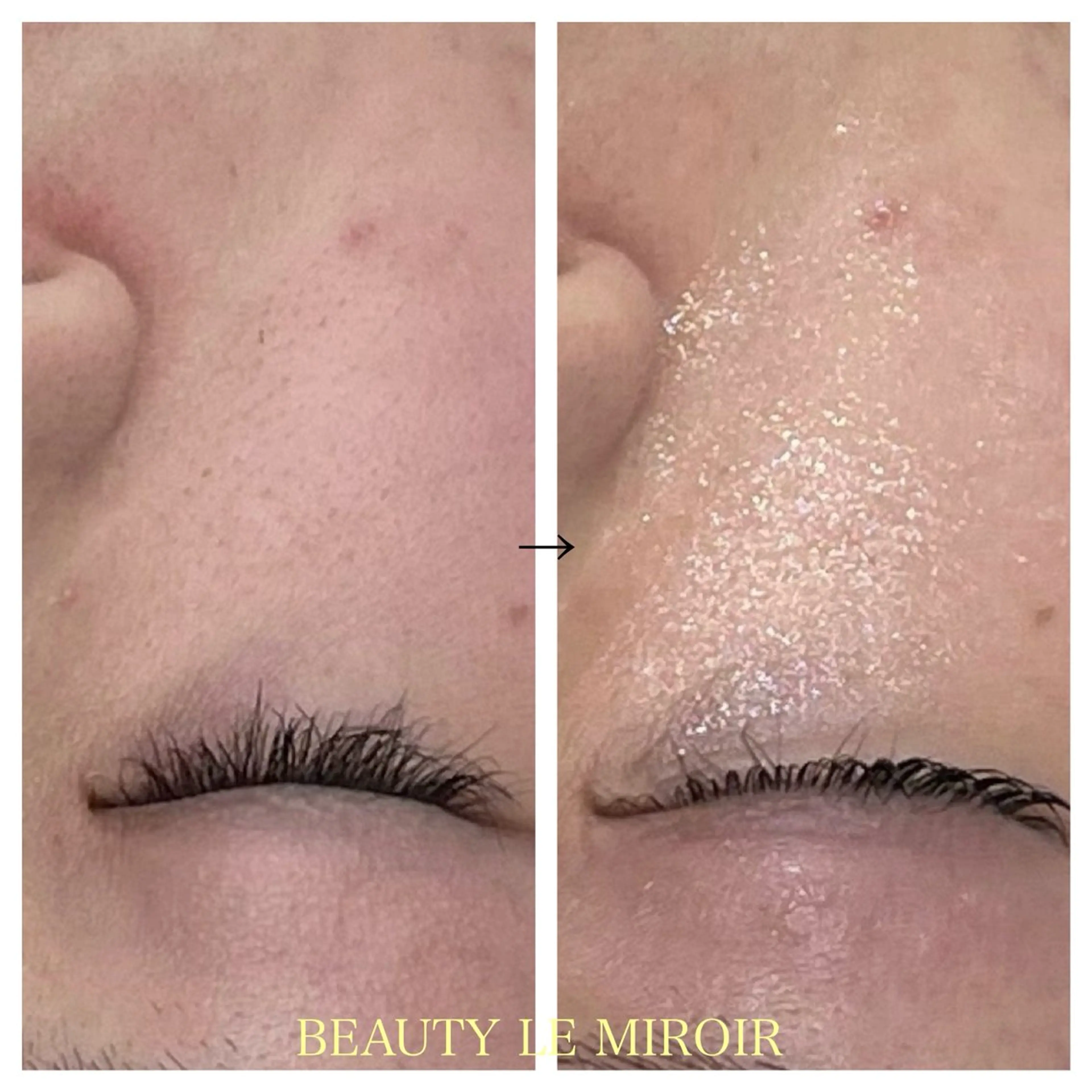 ビューティー ミロワールのエステ・リラクイメージ