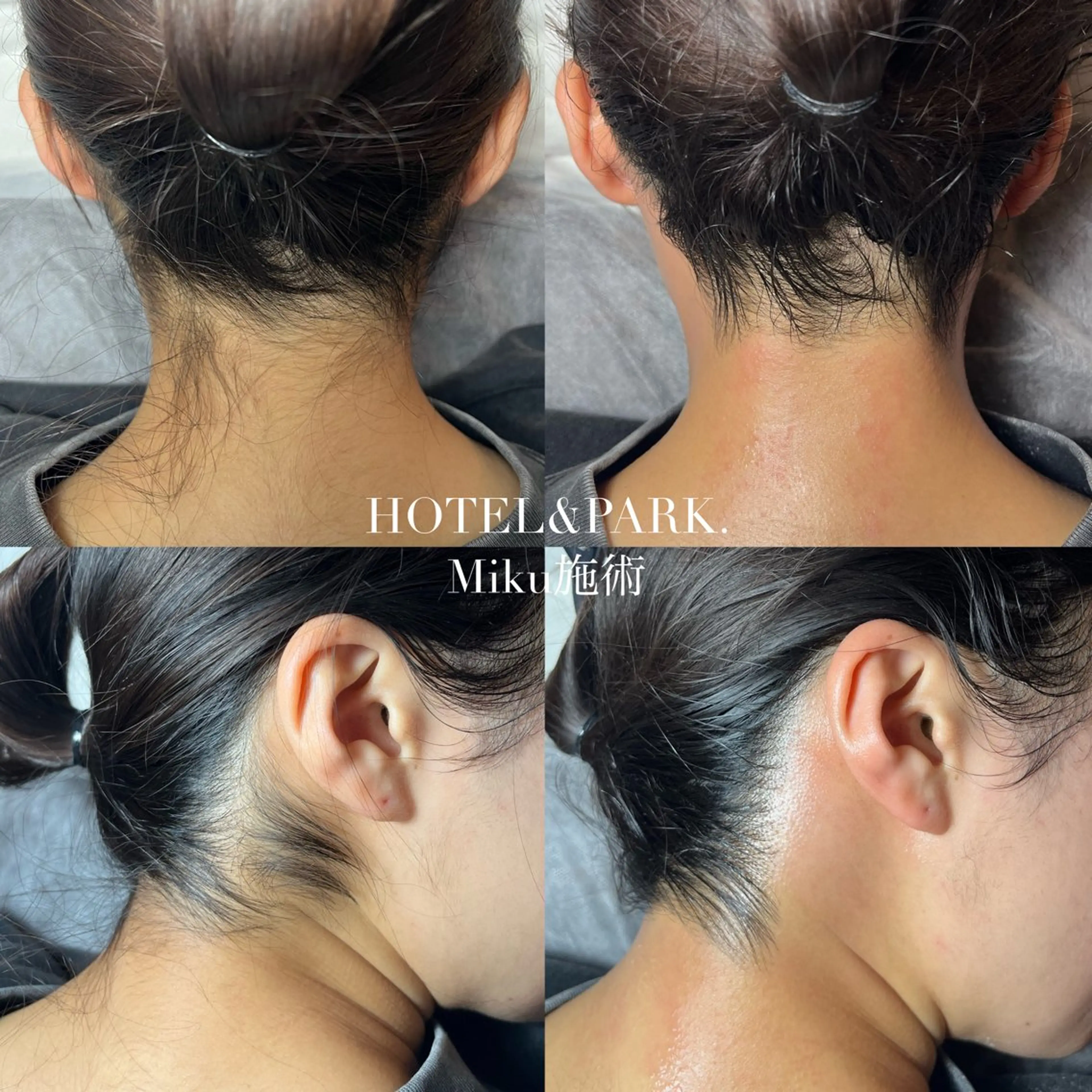 HOTEL&PARK Mikuワックス脱毛のエステ・リラクイメージ