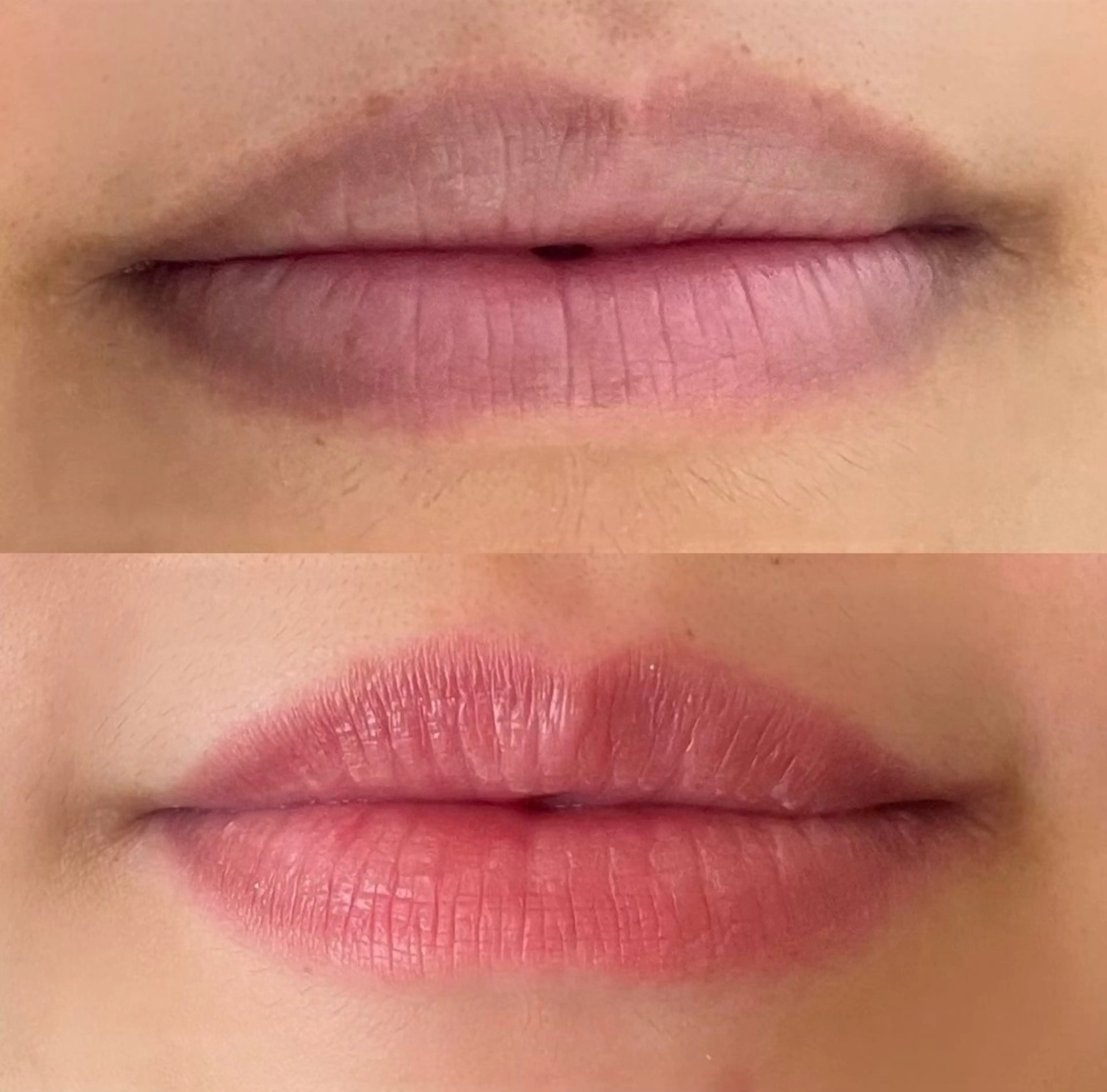 小顔/たるみ/黒ずみ除去専門サロン/SONA 大和西大寺店所属・【小顔専門看護師 サロンSONA】のエステ・リラクイメージ