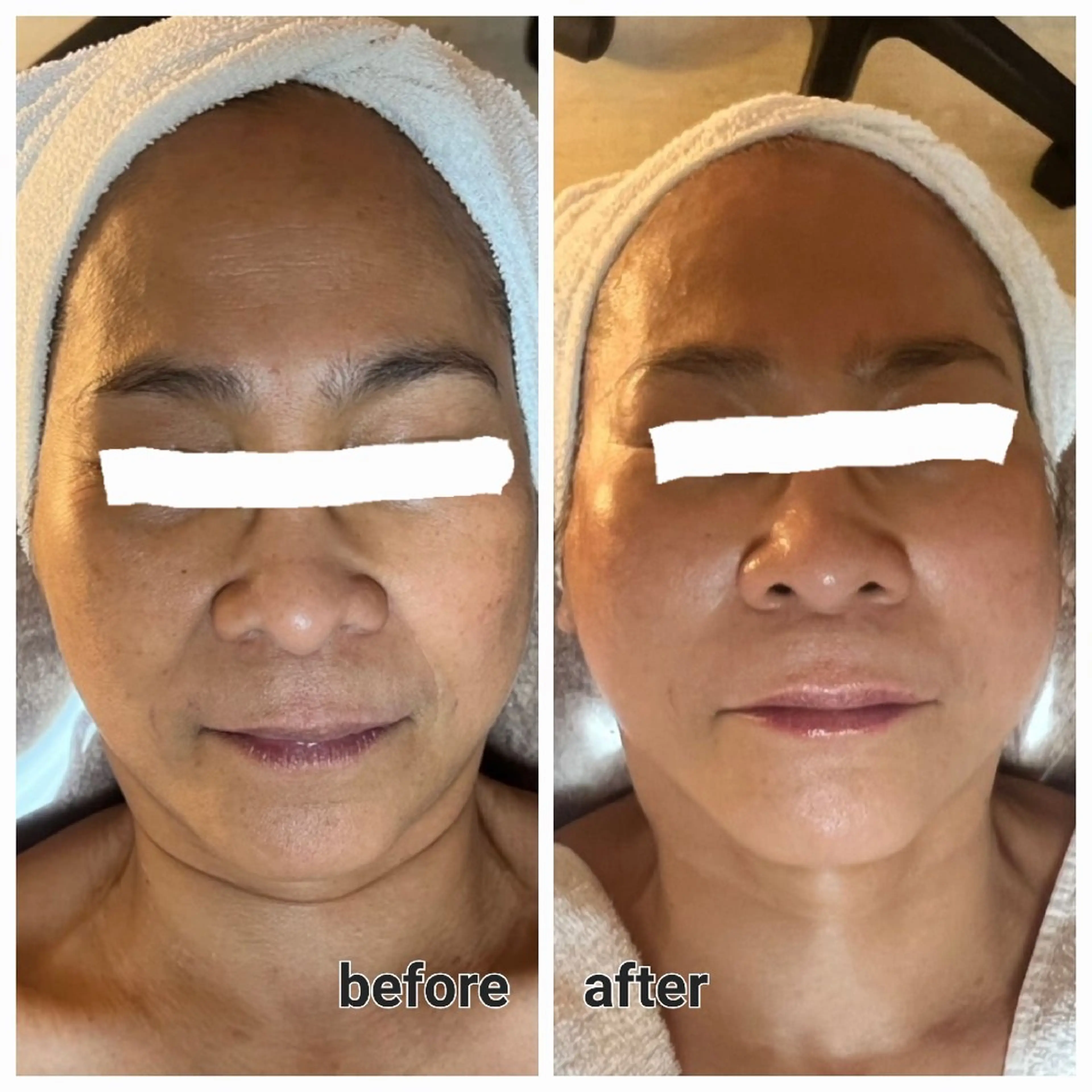 エステ トバル ユリコのエステ・リラクイメージ